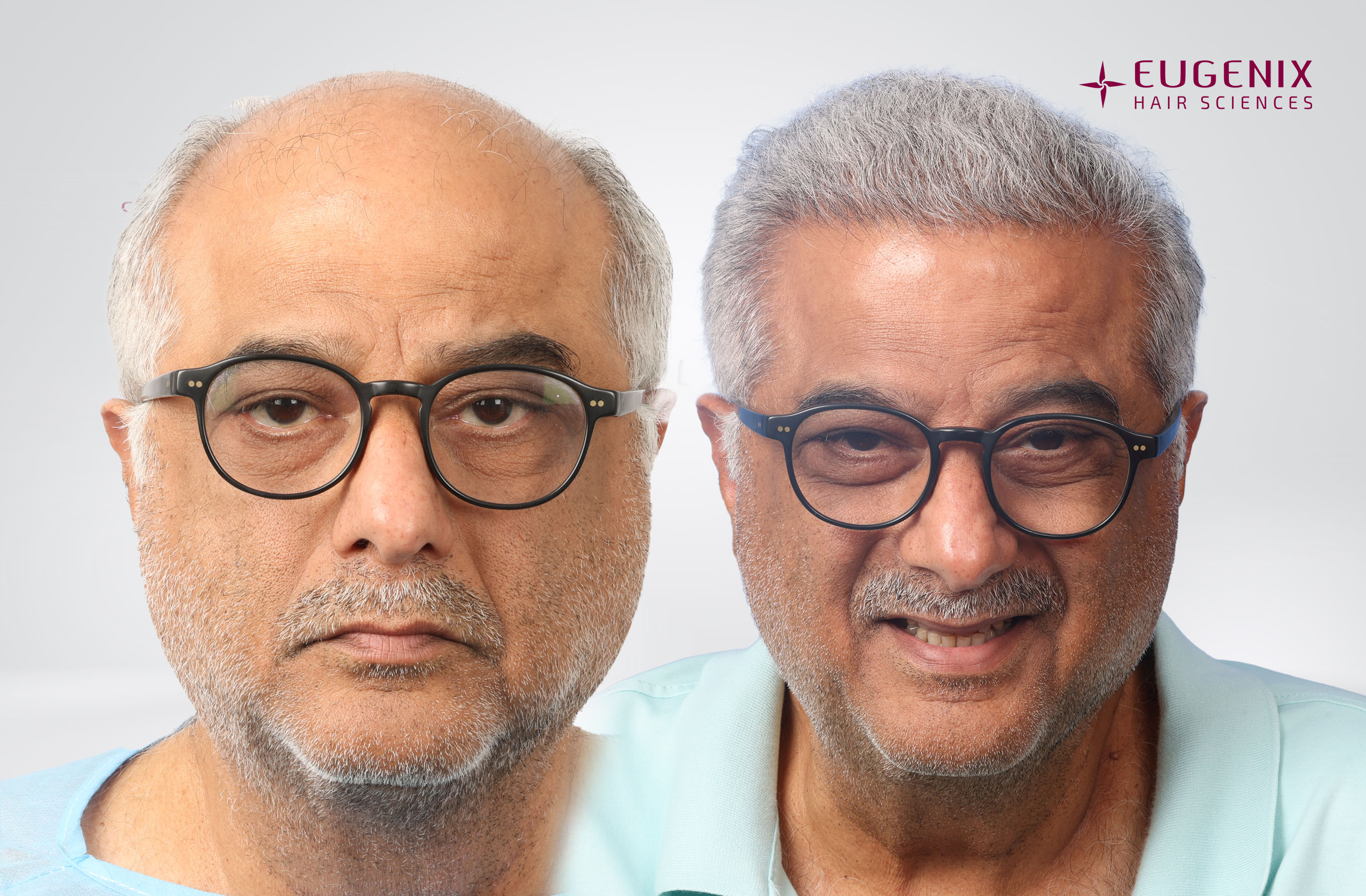 Boney Kapoor Front Before and After