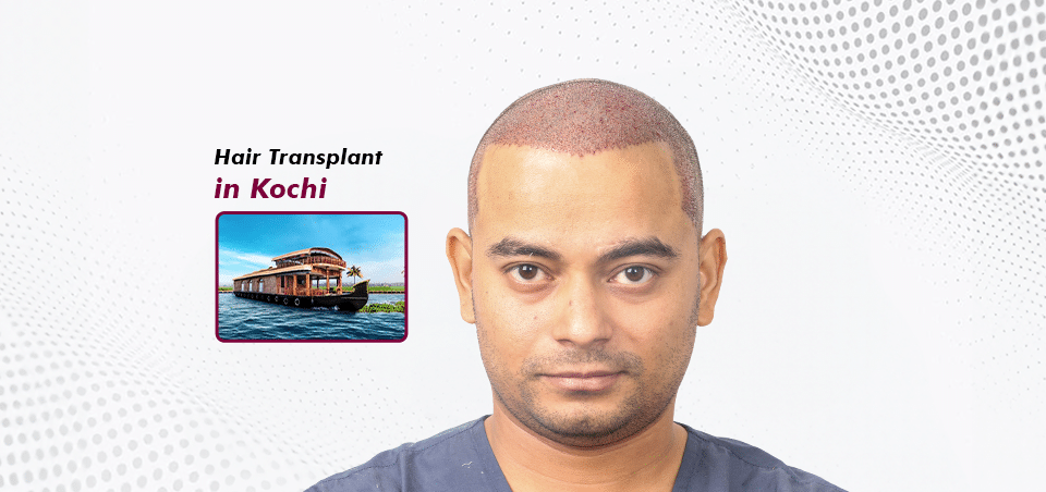 Hair Transplant-in Kochi