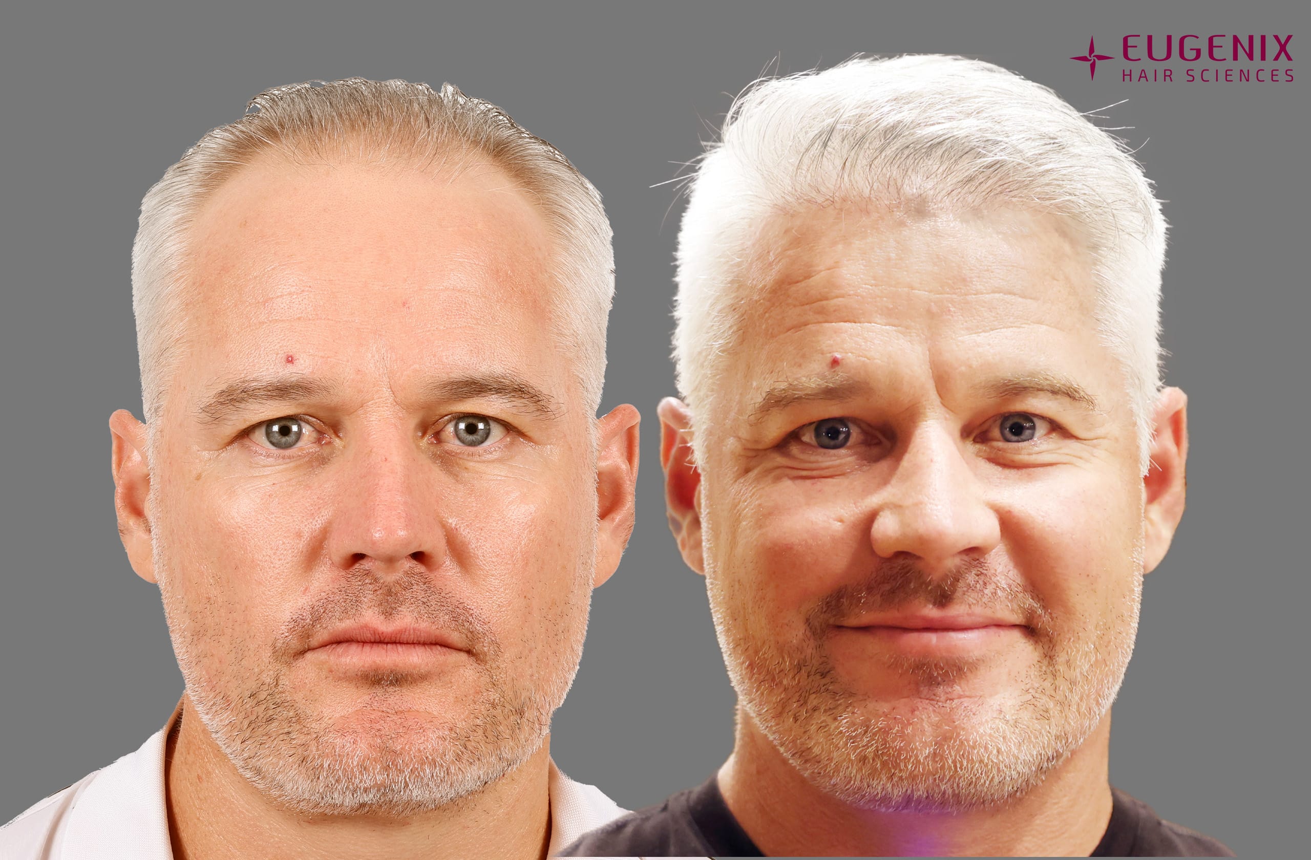 Morne Van Wyk Before and After Front
