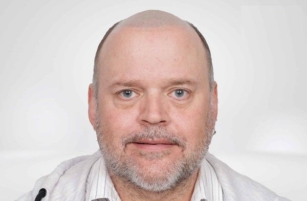 Adrian-Front-Before