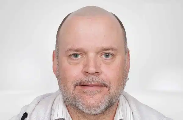 Adrian-Front-Before