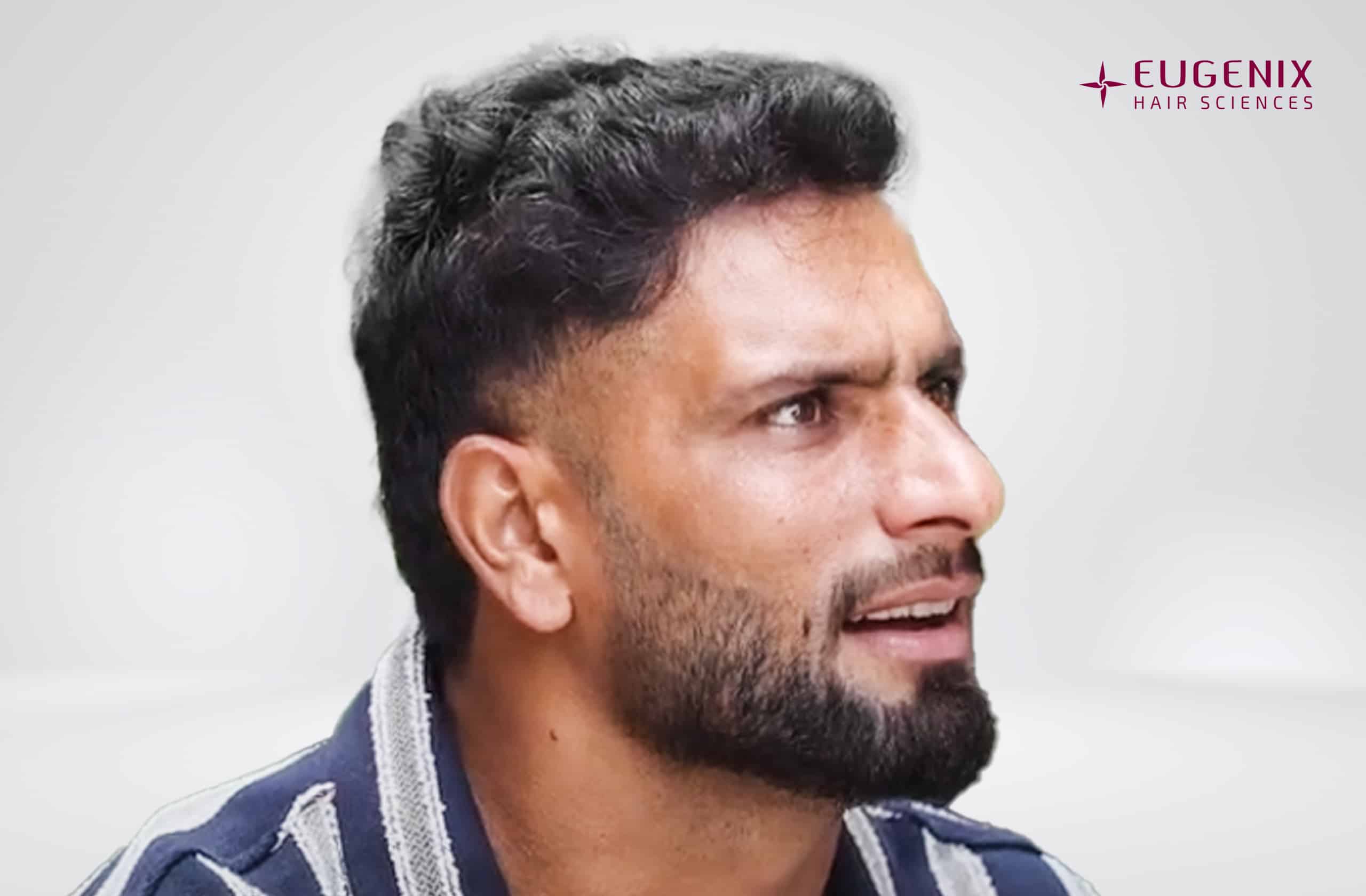 Fareed Ahmad After Right