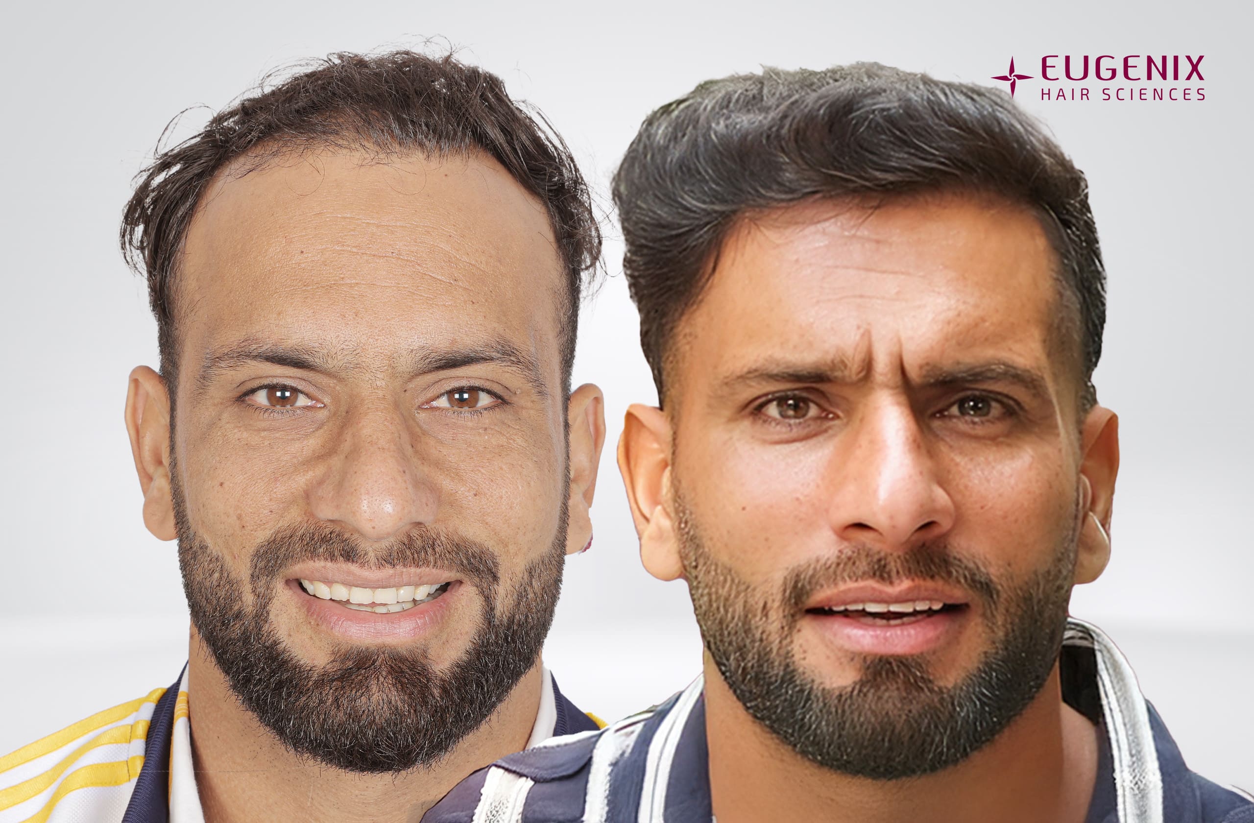 Fareed Ahmad Before After Front