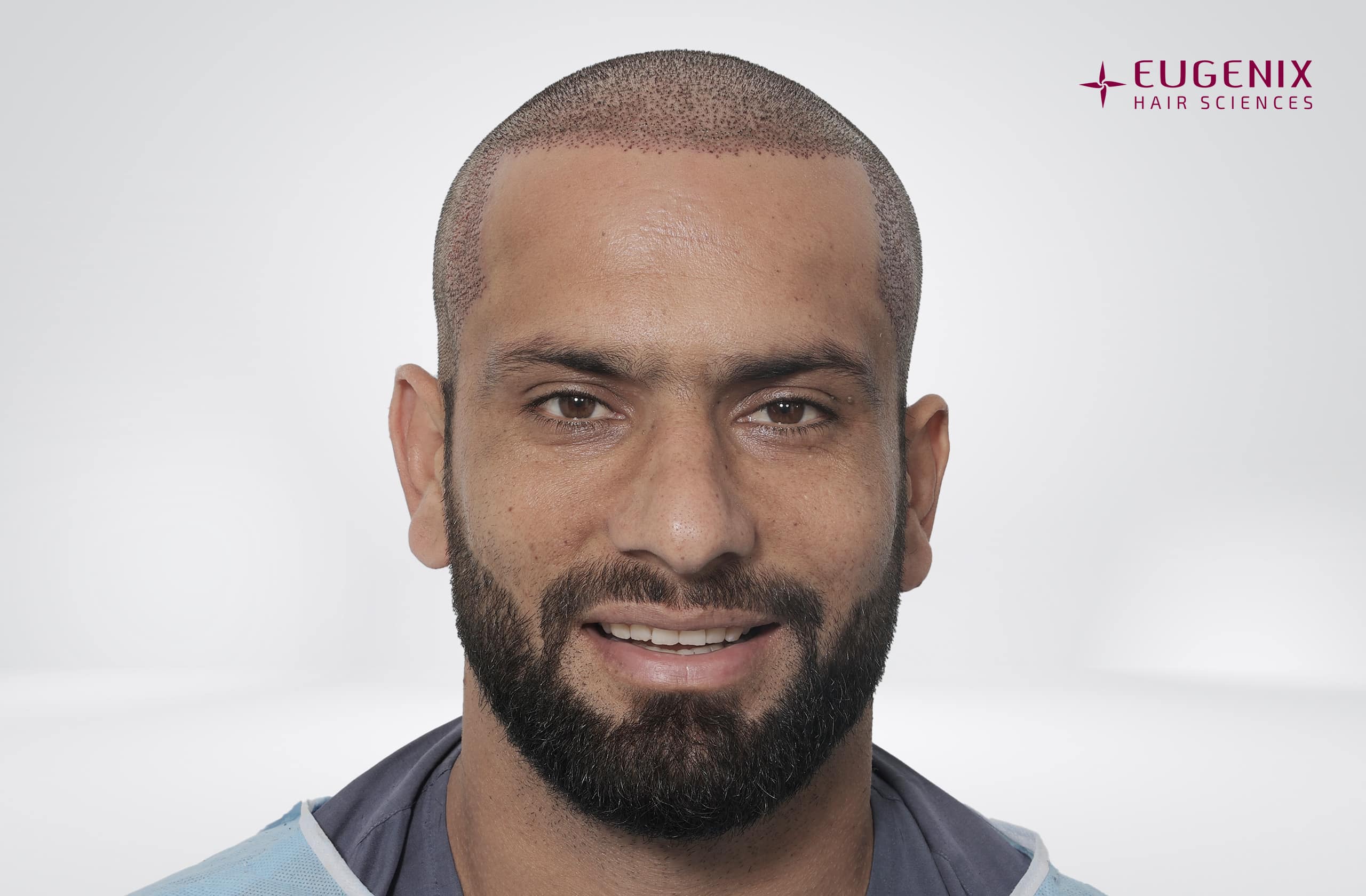 Fareed Ahmad Post-op Front