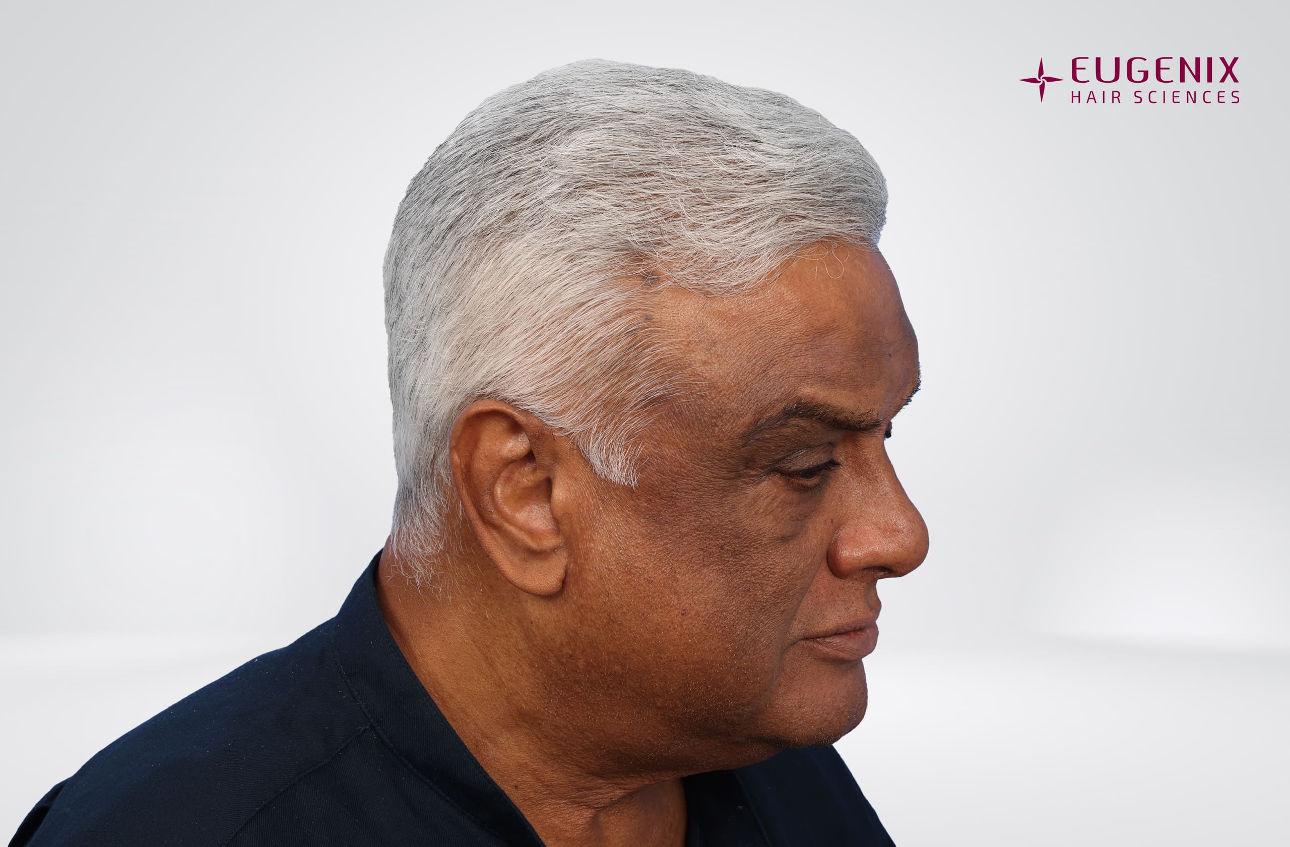 Satish Menon After Right