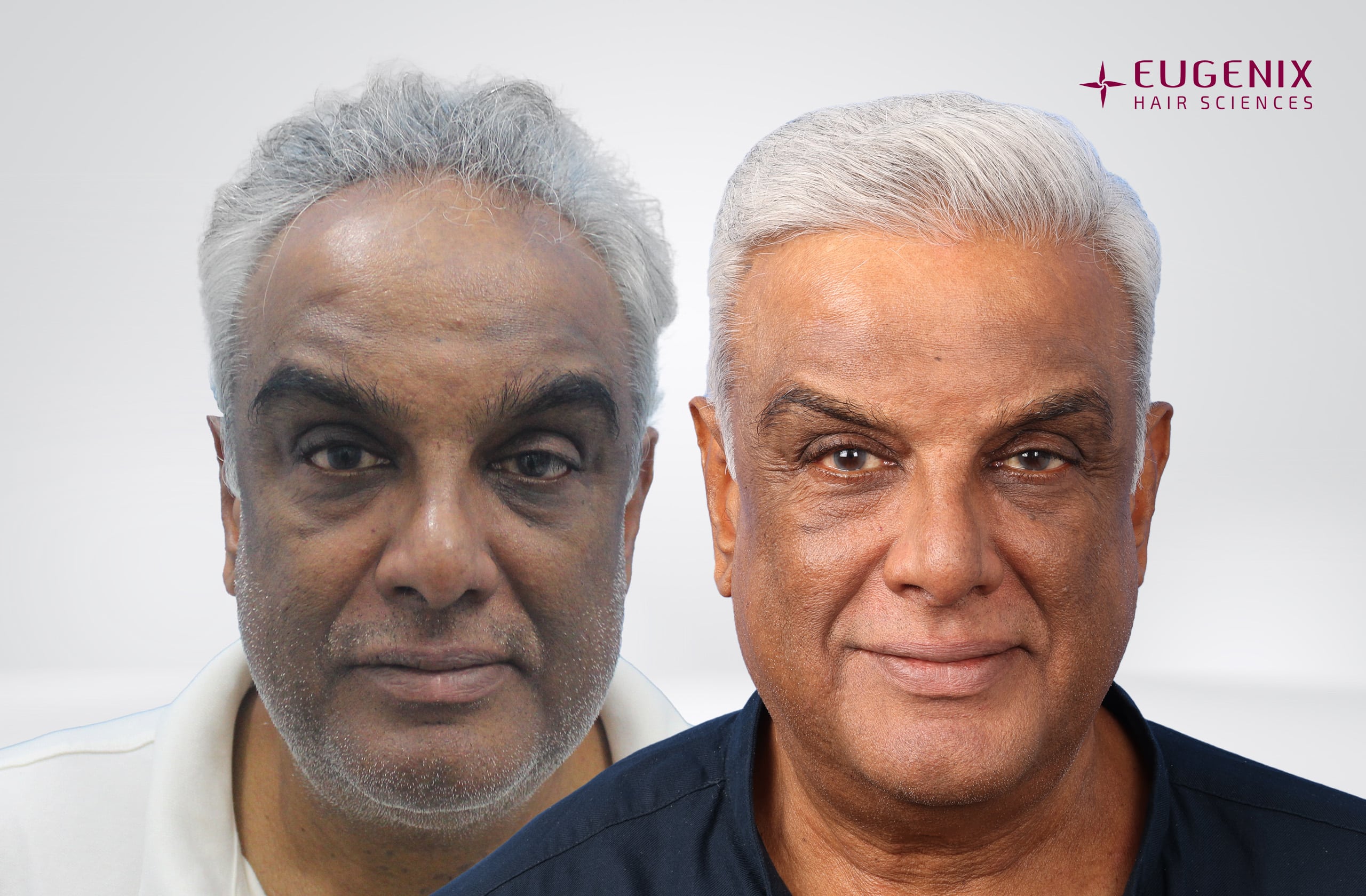 Satish Menon Before After Front