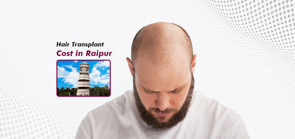 Hair Transplant_in Raipur