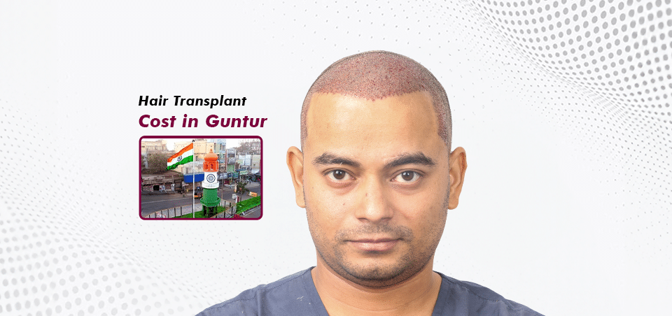 hair-transplant-cost-in-guntur