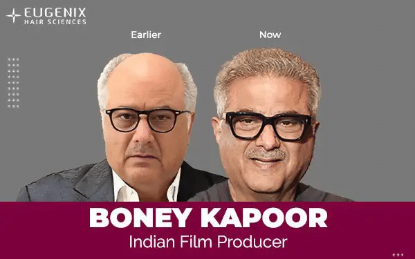 boneykapooreugenix