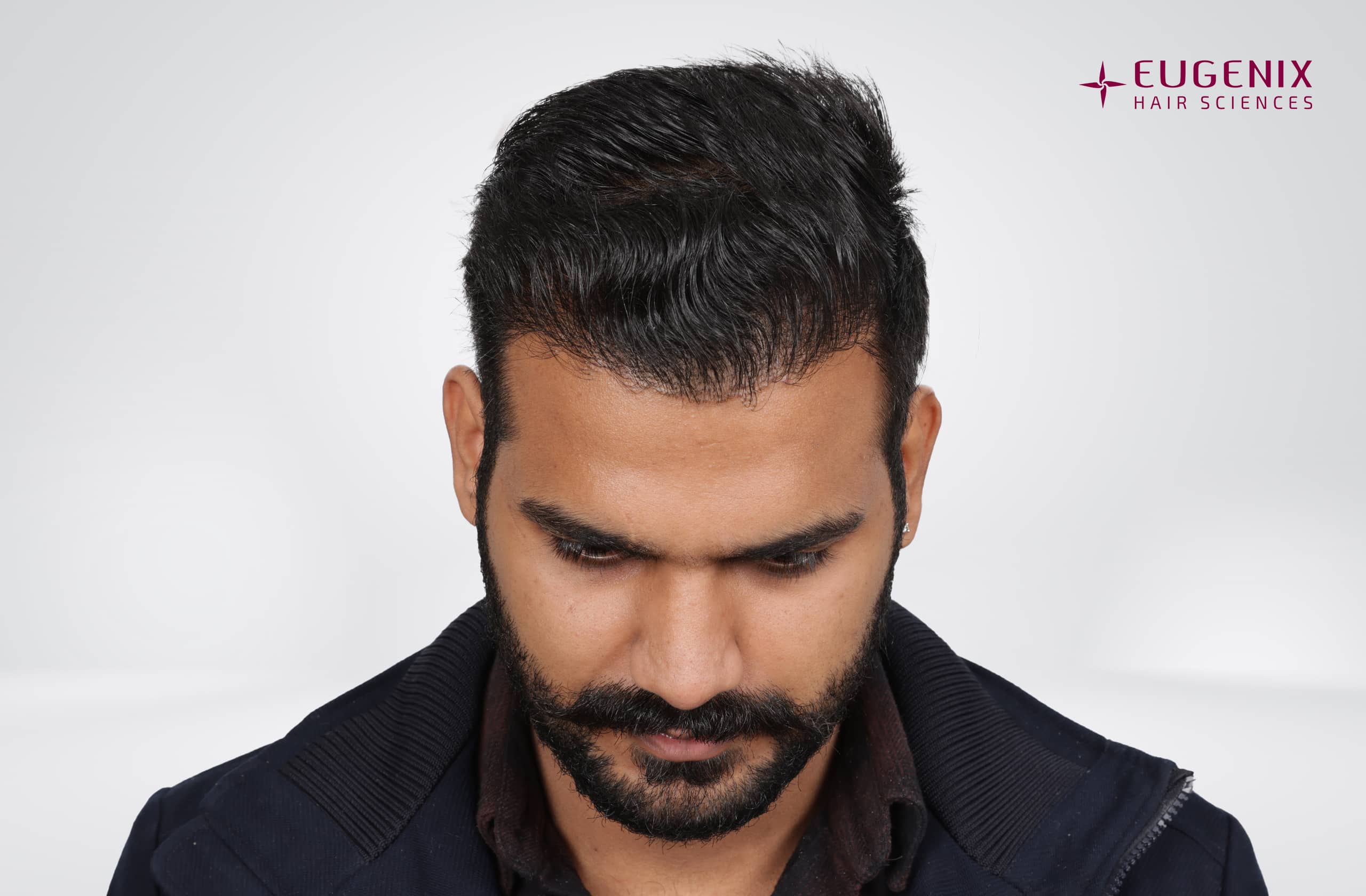 Paramvir Singh Benival Before Head Down copy