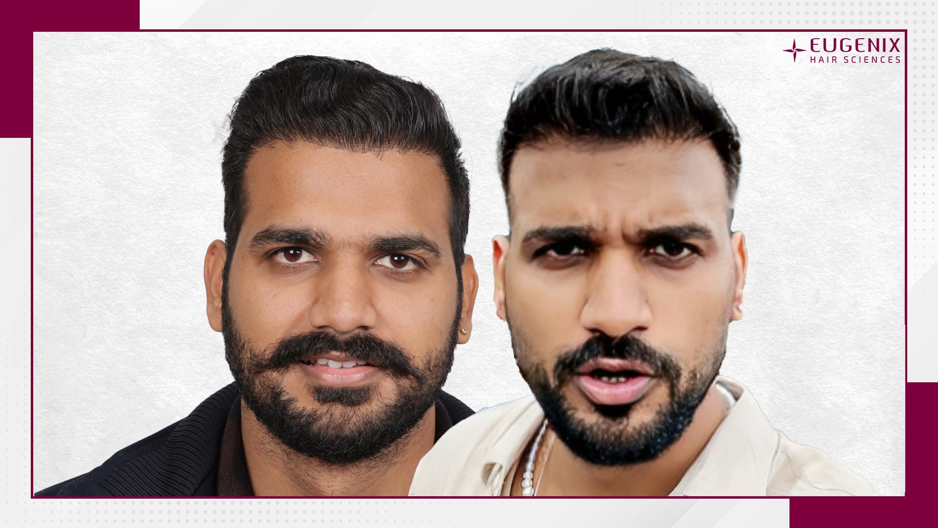 Paramvir Singh Benival Blog Before and After copy