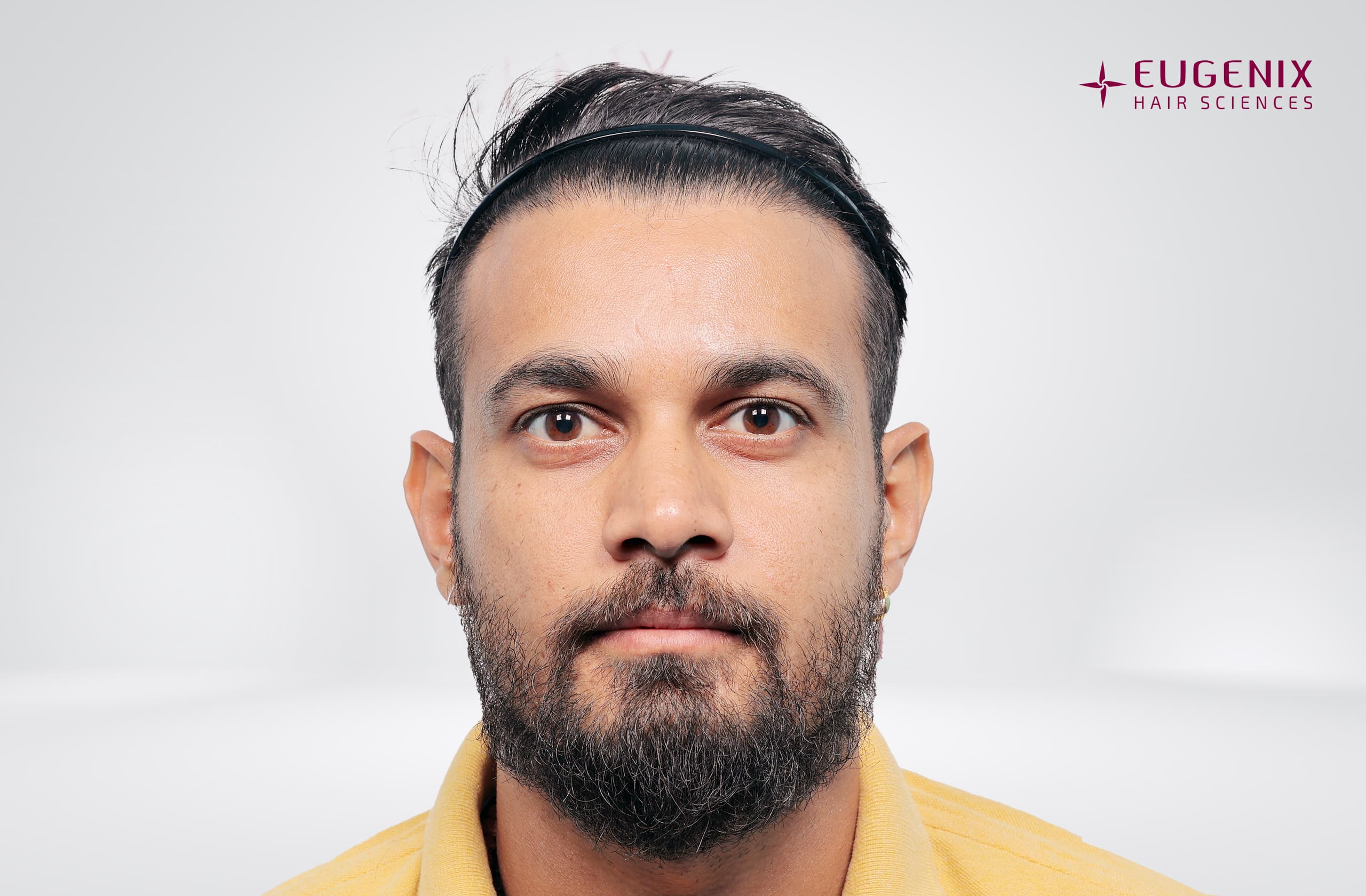 Siddharth Kaul After Front copy