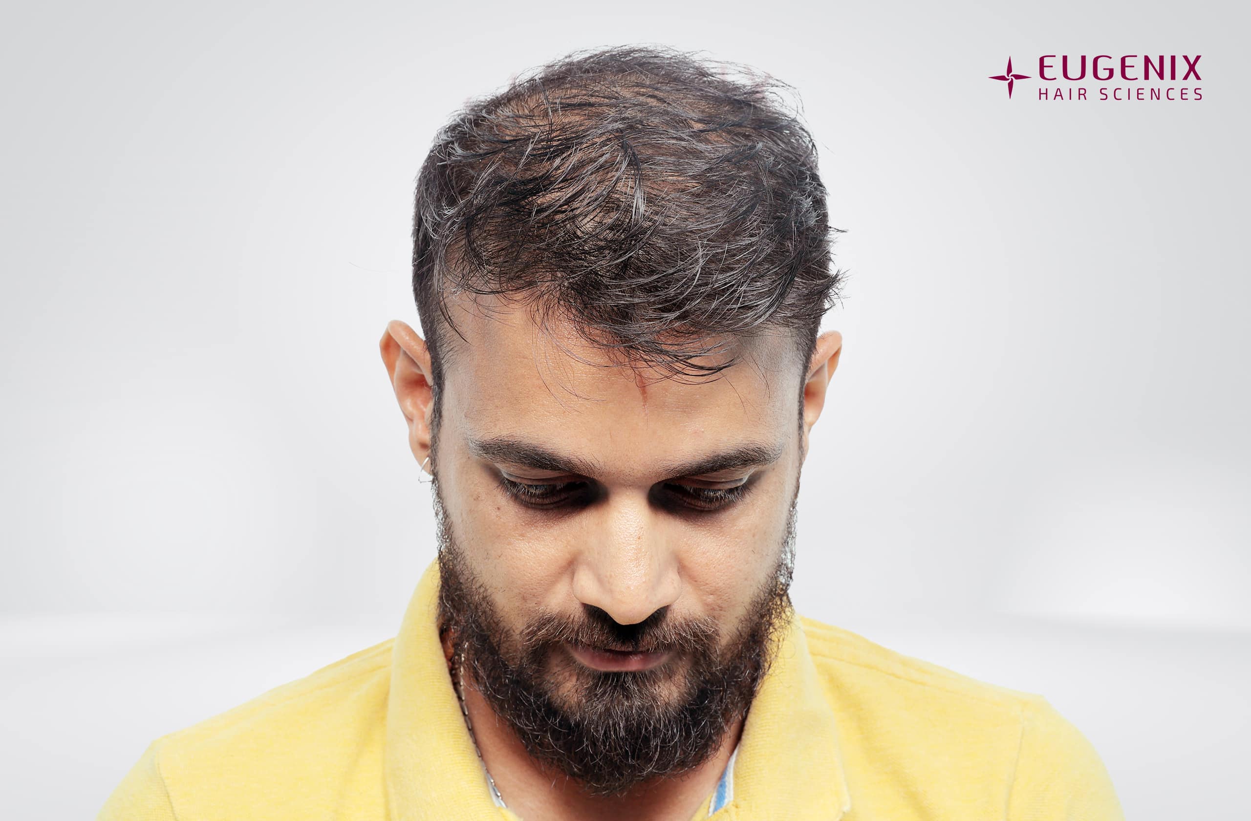 Siddharth Kaul After Head Down copy
