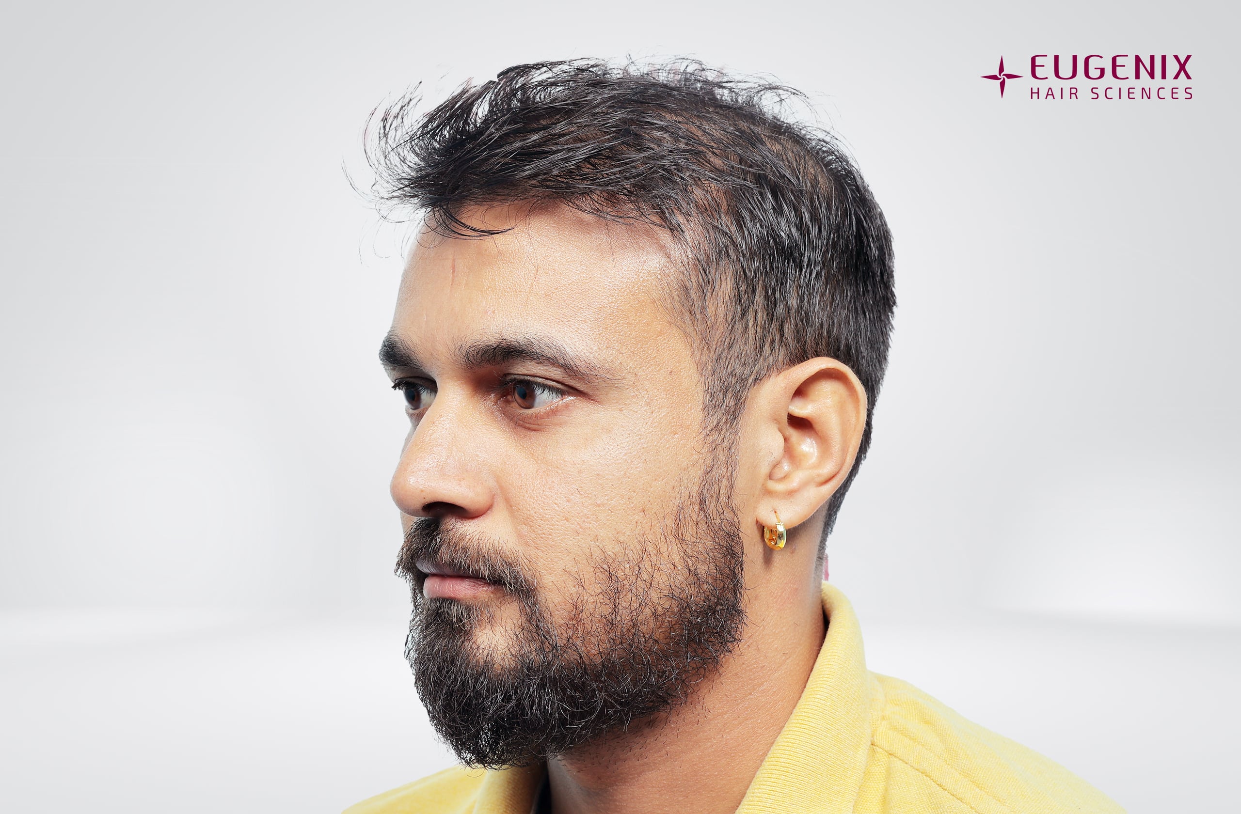 Siddharth Kaul After Right copy