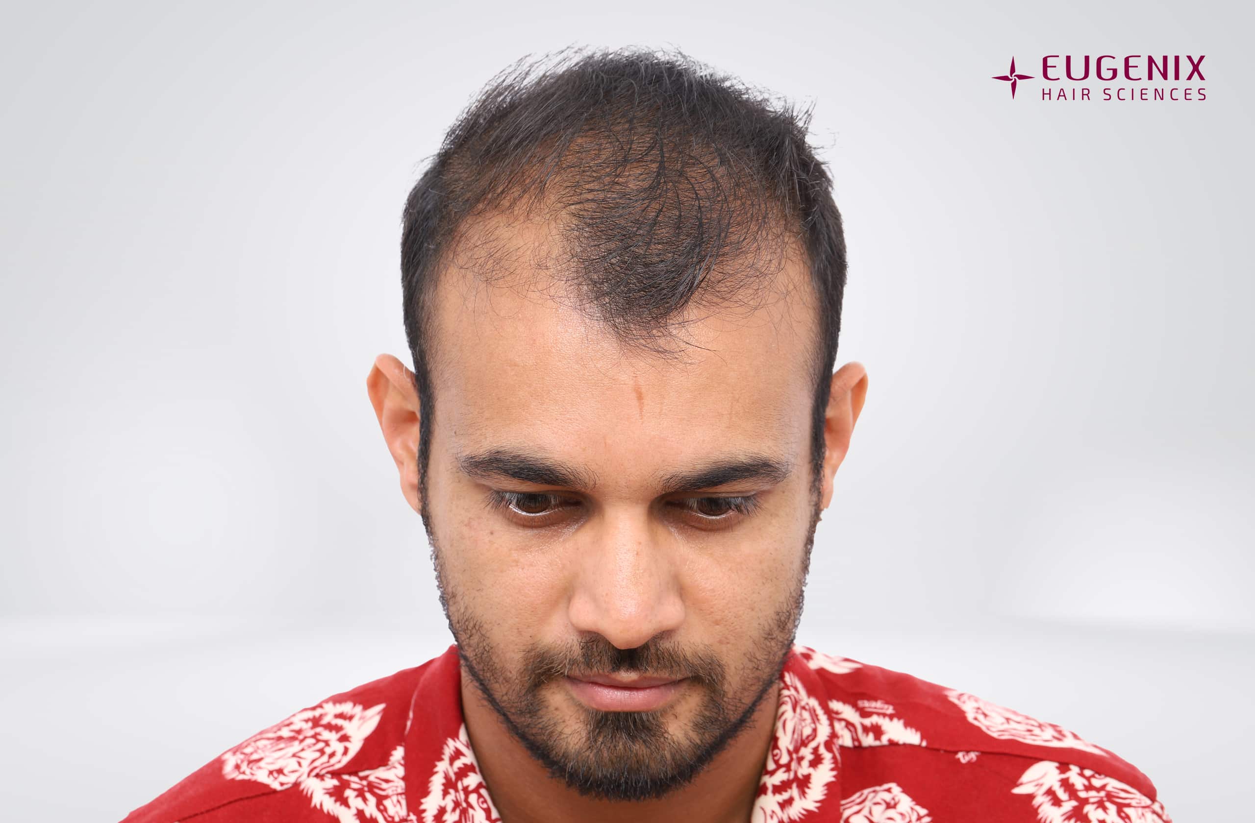 Siddharth Kaul Before Head Down copy