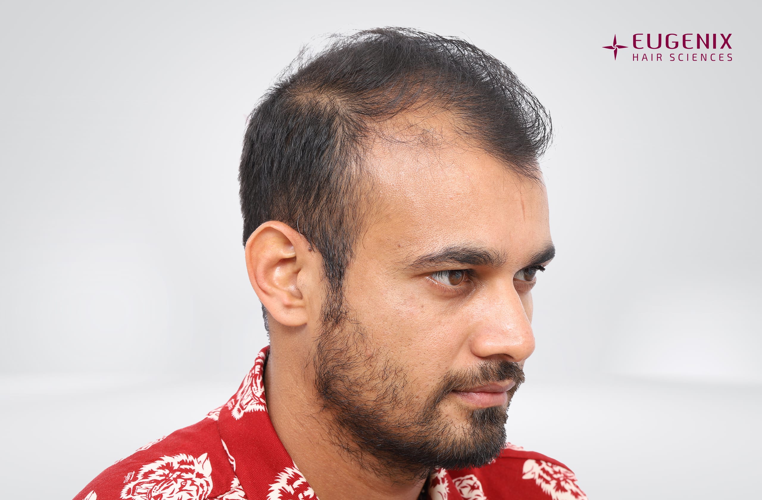Siddharth Kaul Before Left copy
