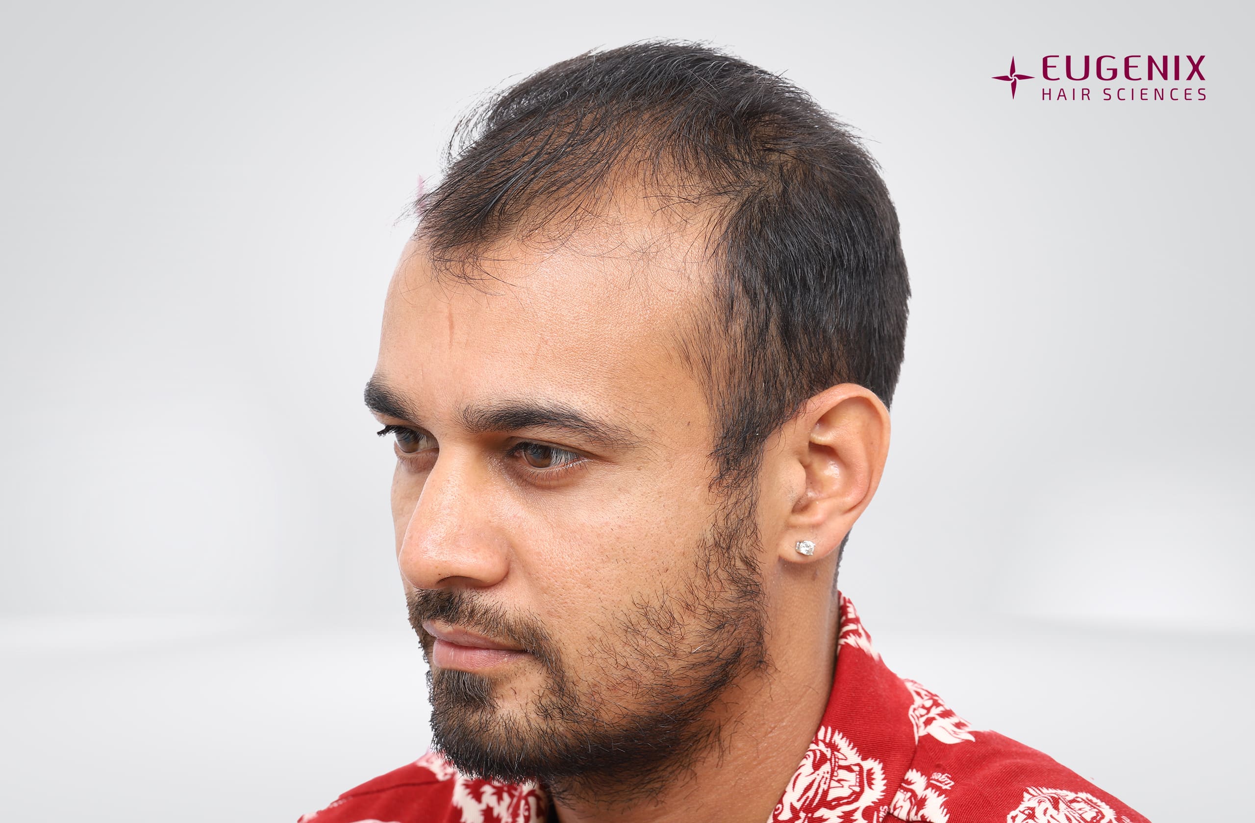 Siddharth Kaul Before Right copy