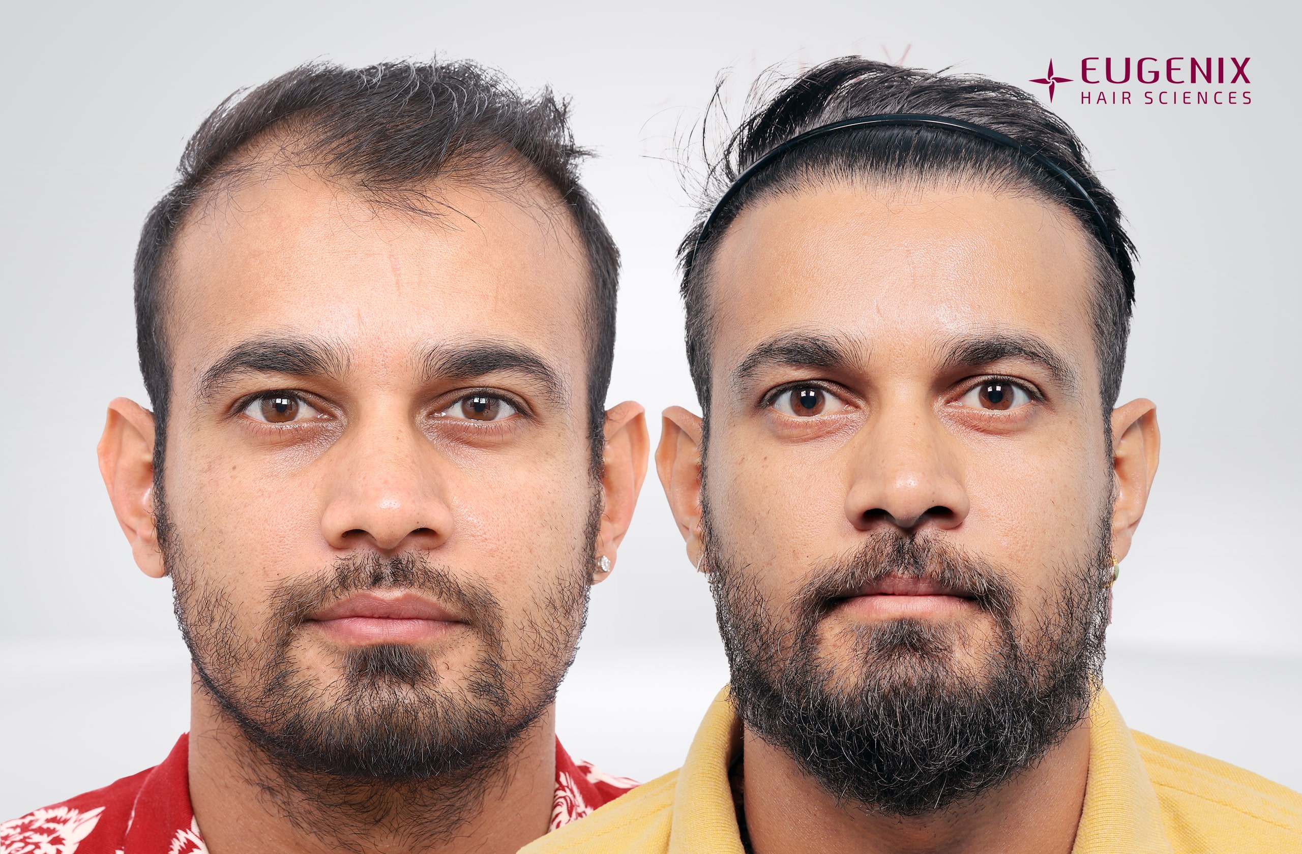 Siddharth Kaul Before and After Front copy