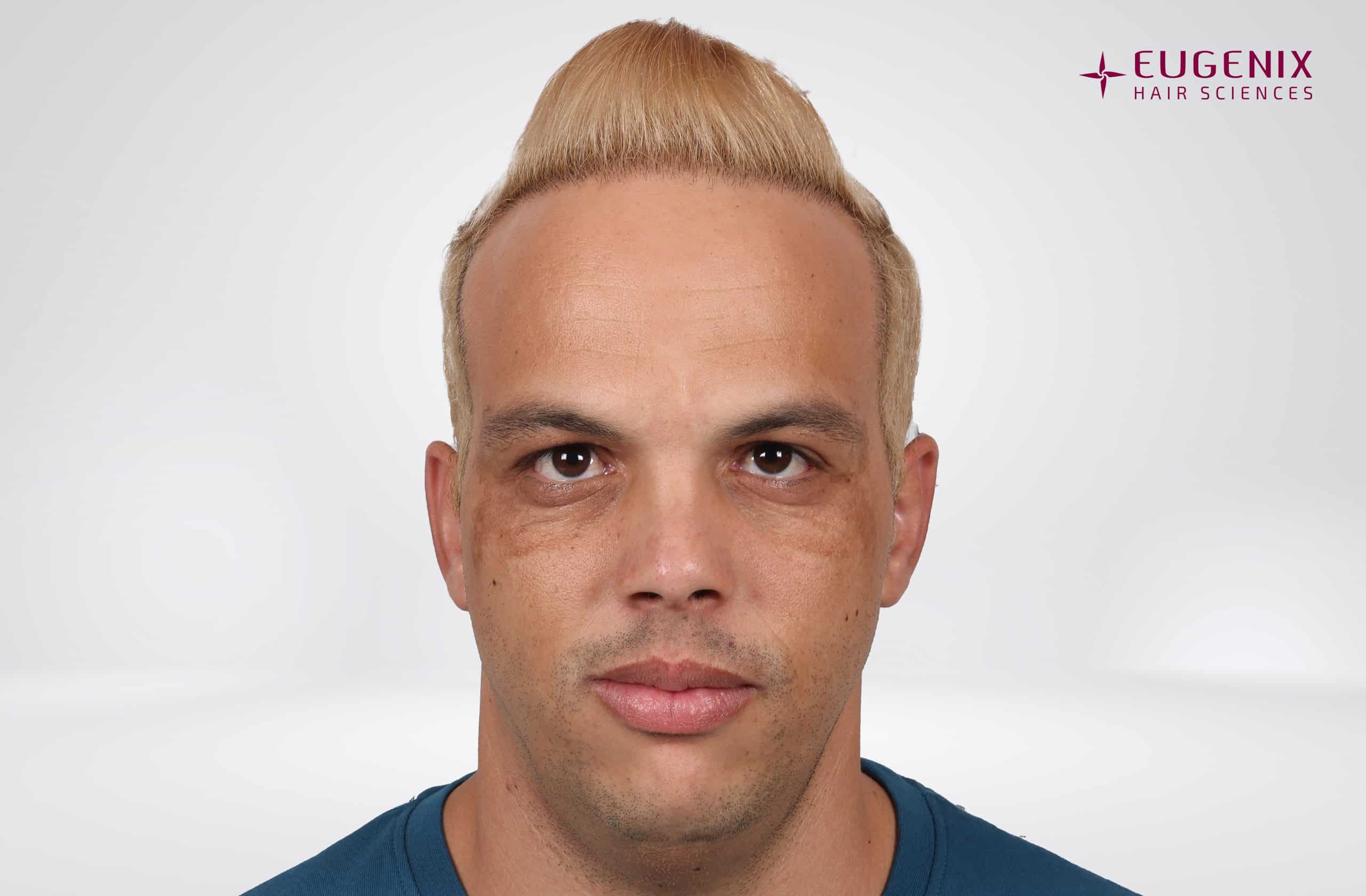 Anton-Front-AFter