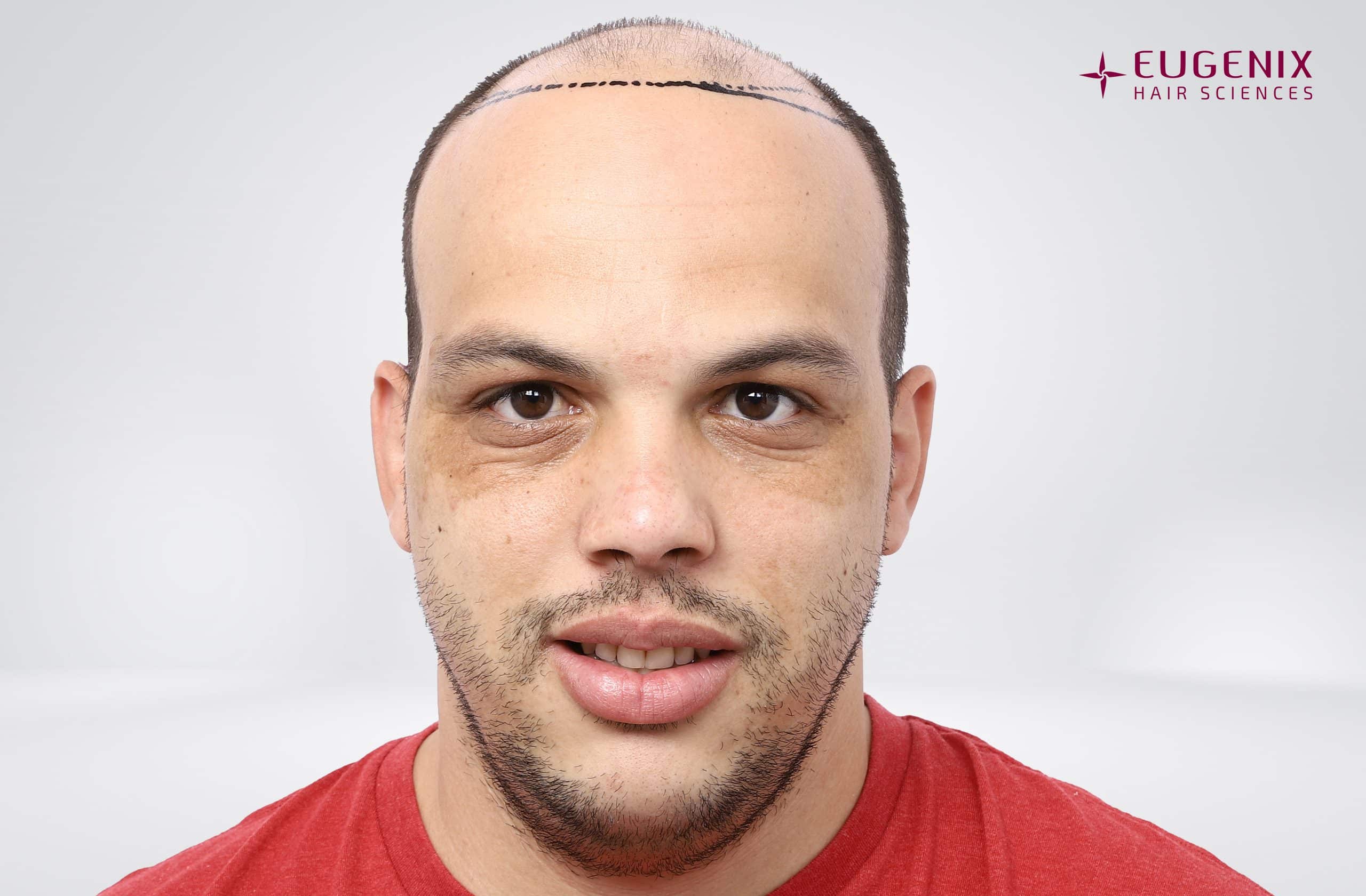 Anton-Front-Planning