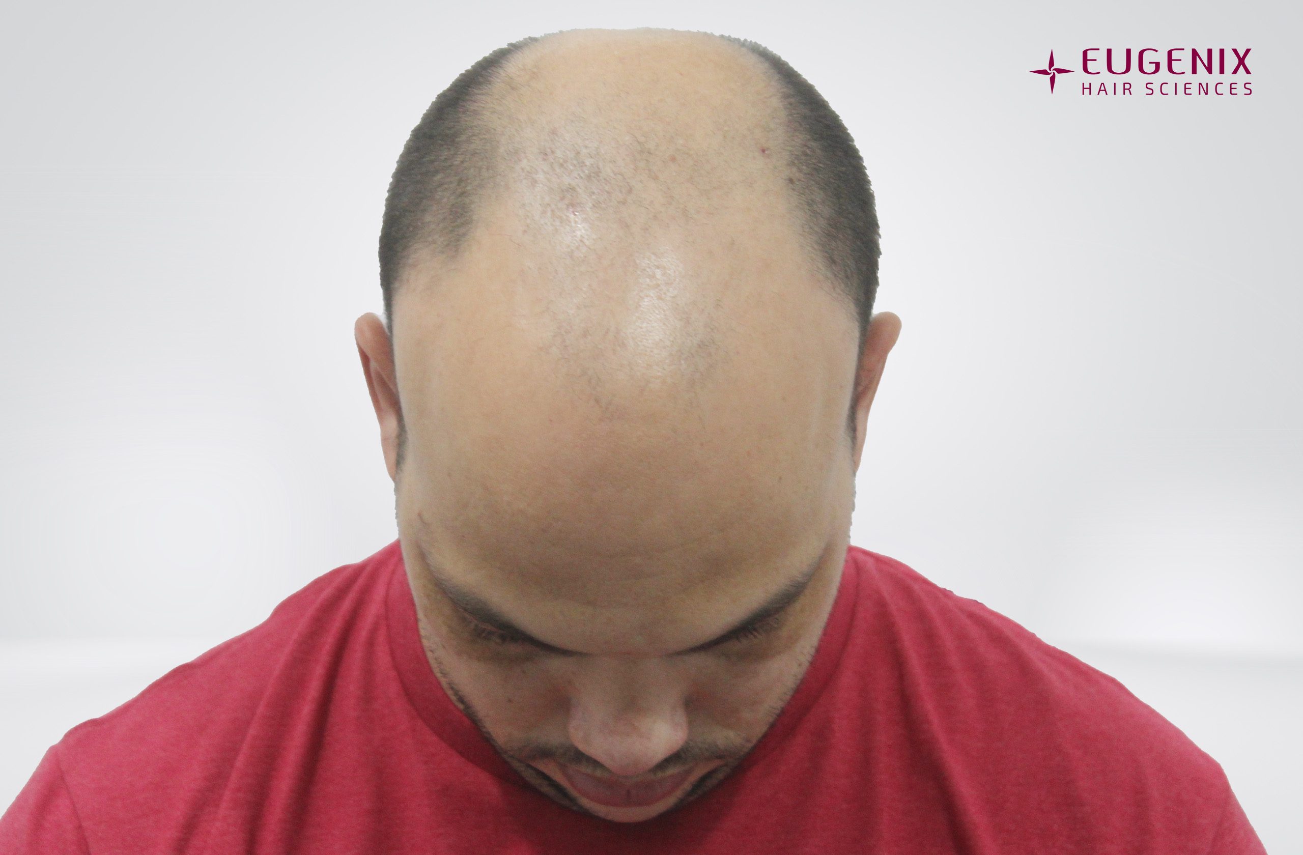 Anton-Head-Down-Before
