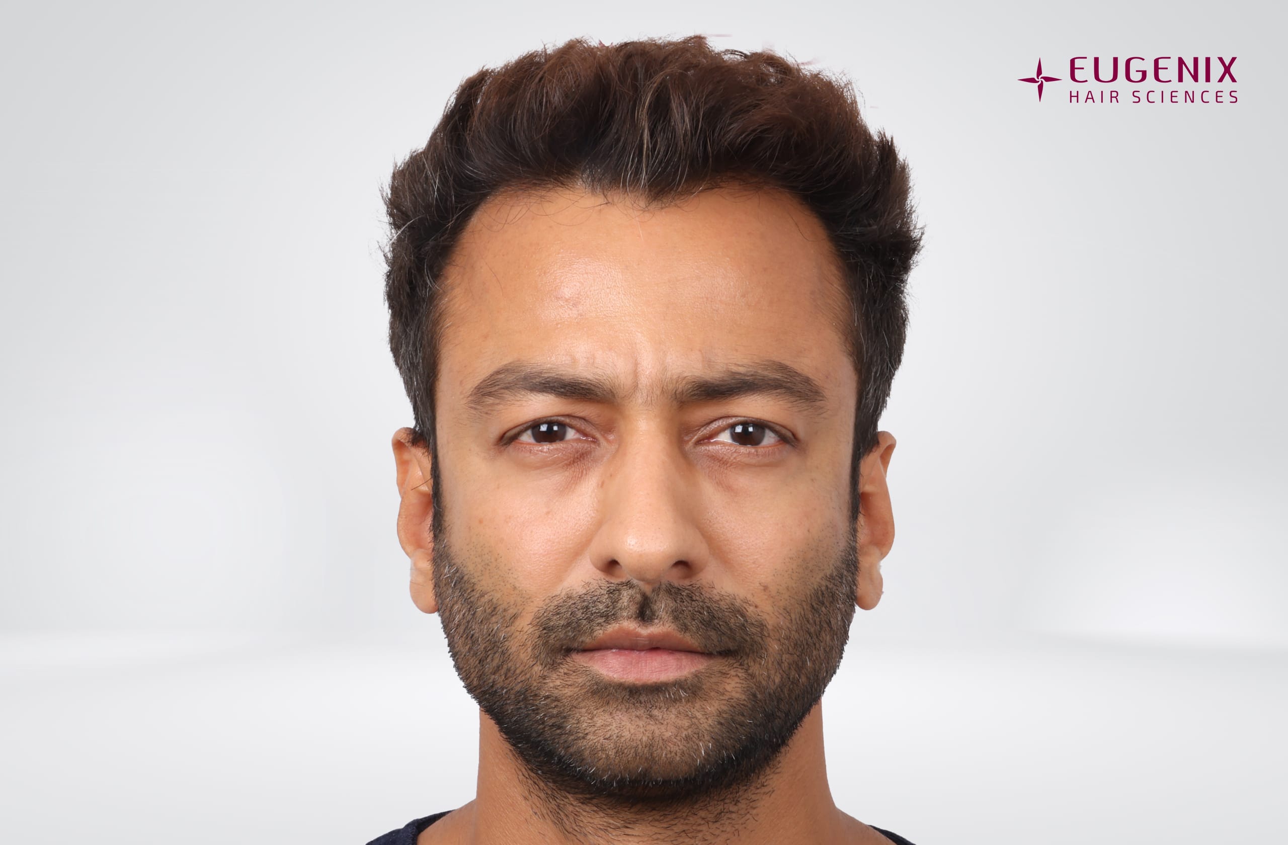 Jatin Shah Front Before copy