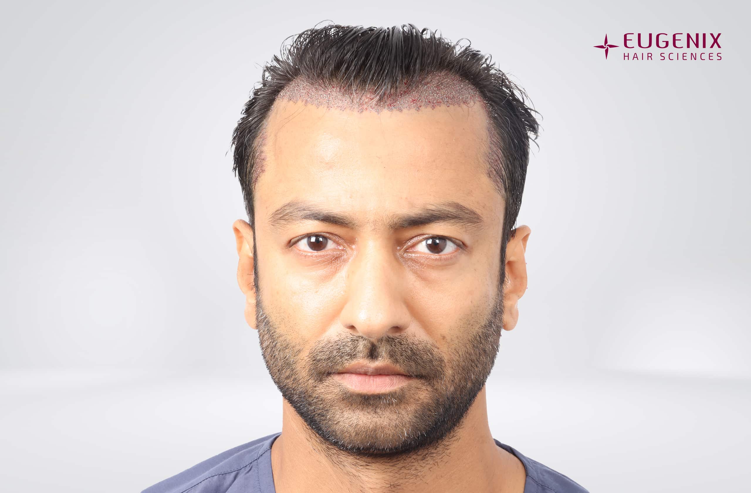 Jatin Shah Front Post-op copy