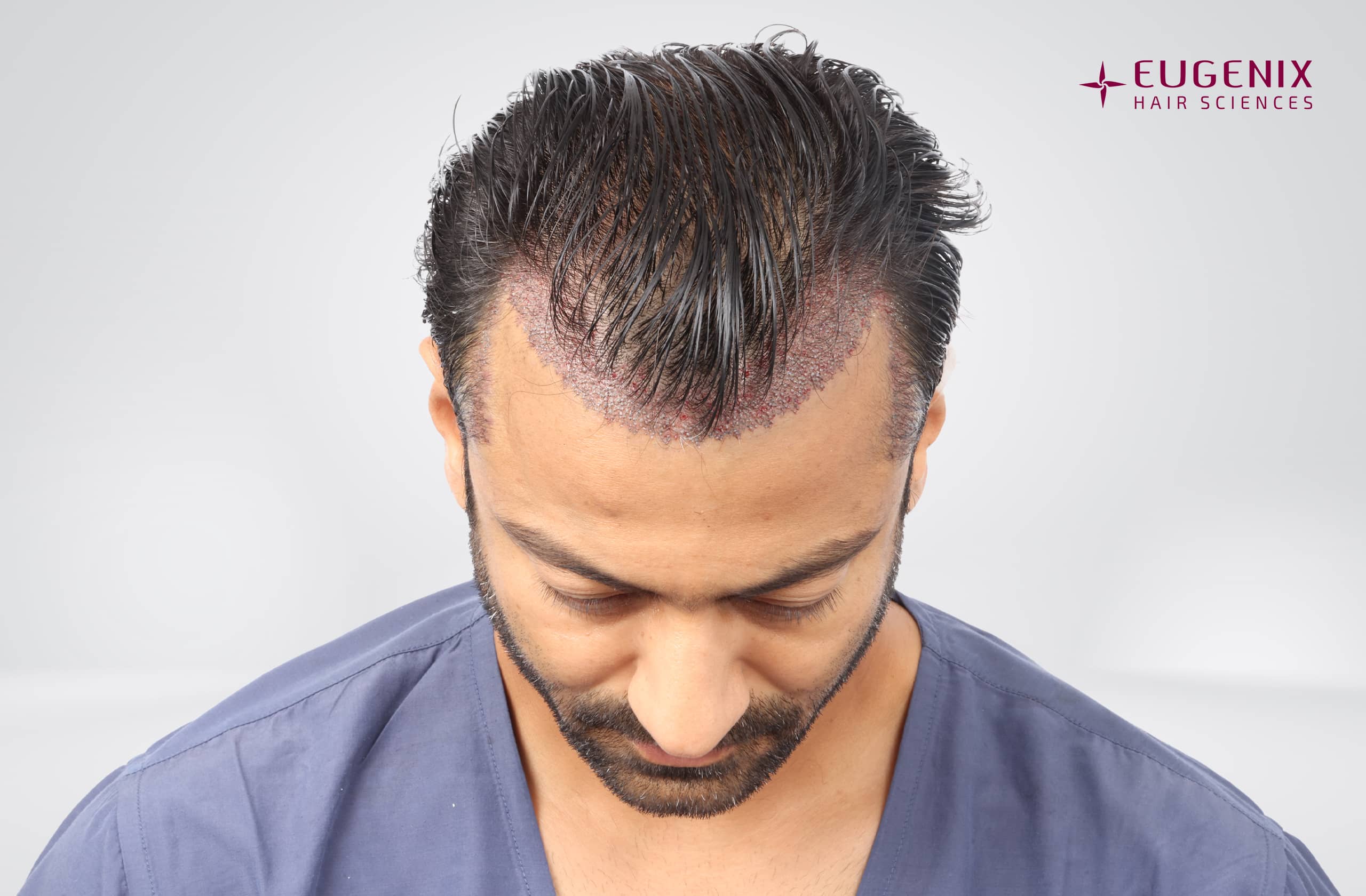 Jatin Shah Head Down Post-op copy
