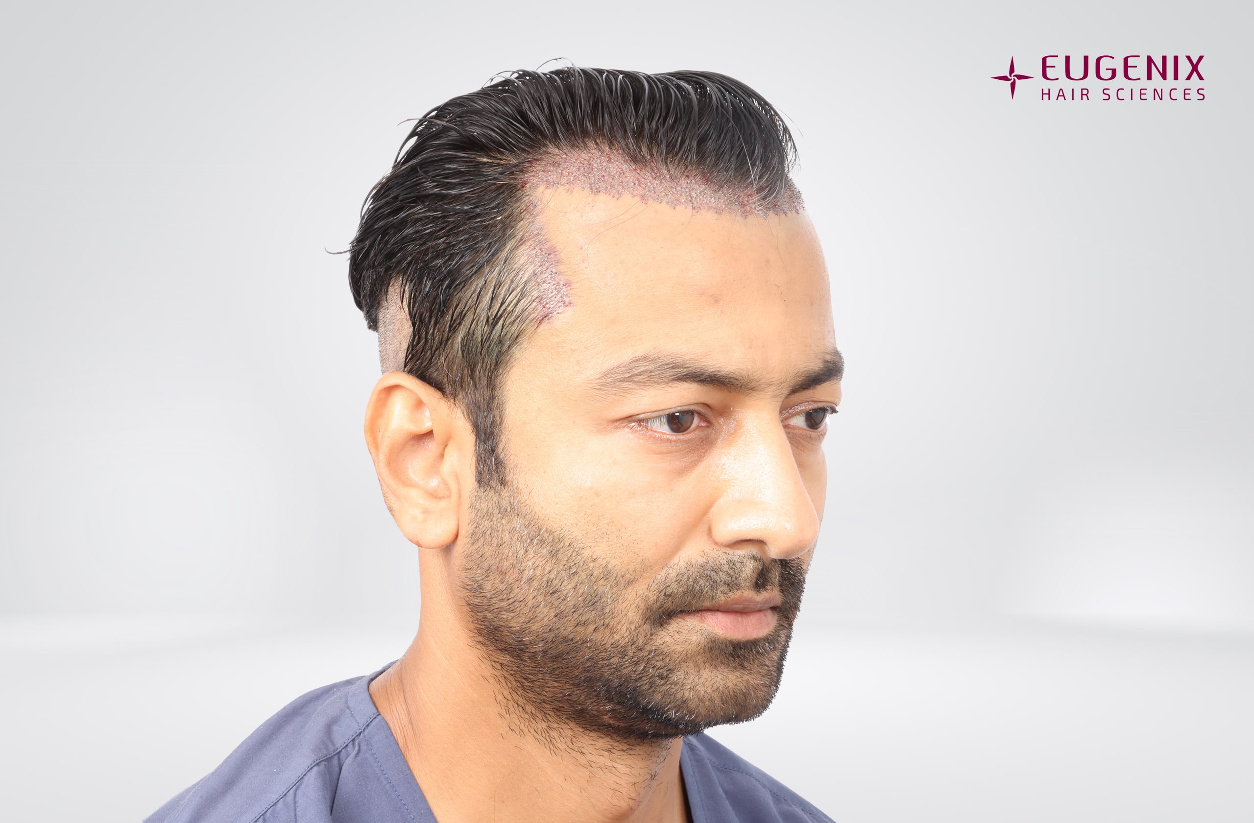 Jatin Shah Left Post-op copy