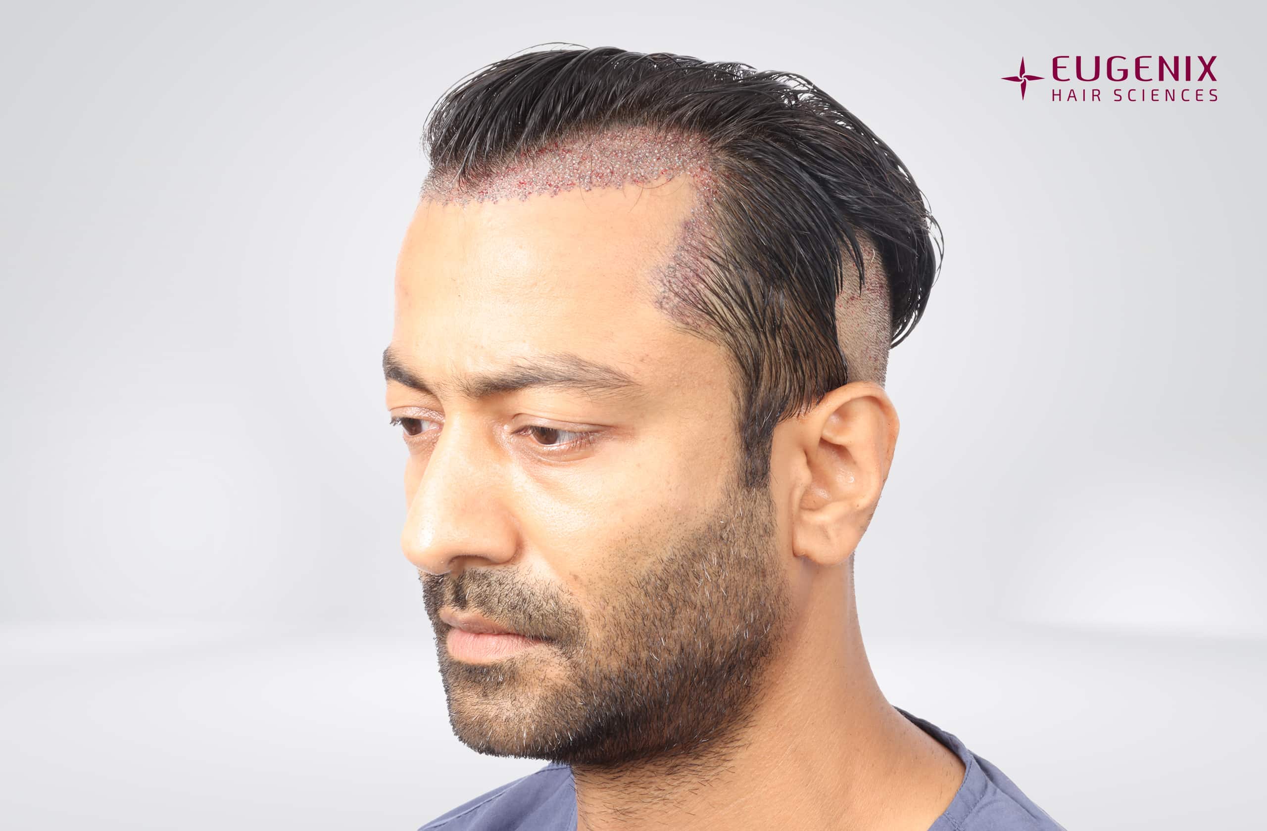 Jatin Shah Right Post-op copy