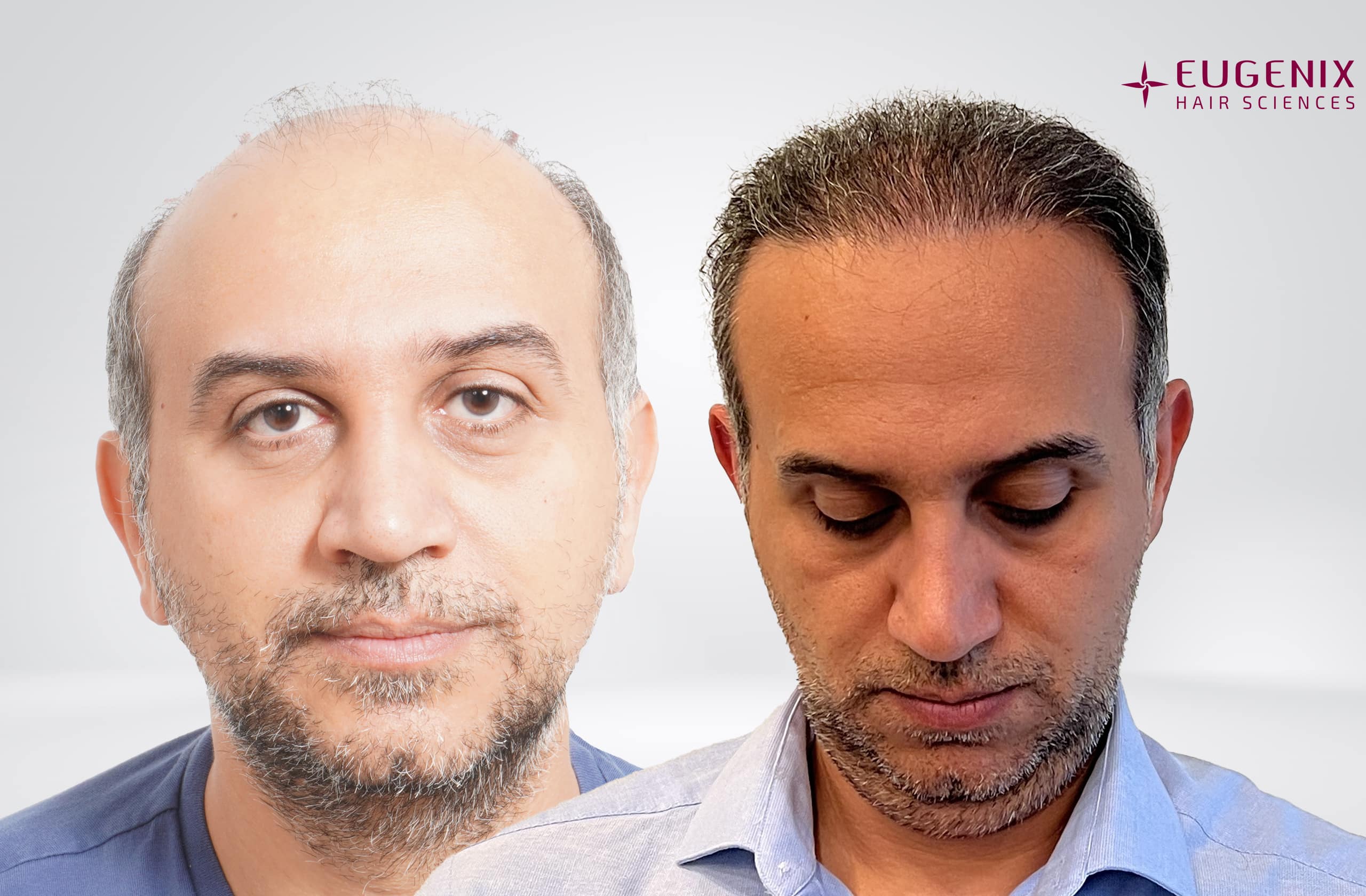 Mr-AS-Before-After