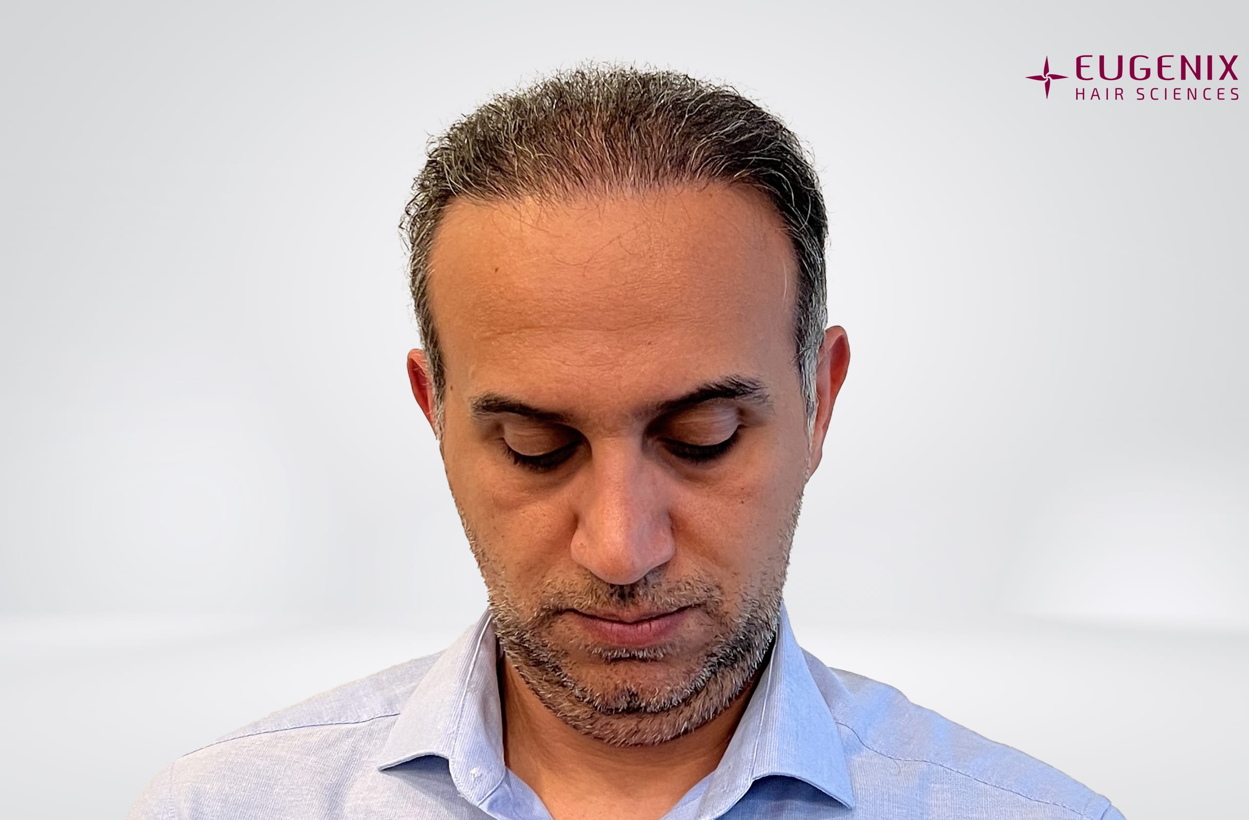 Mr-AS-Front-After