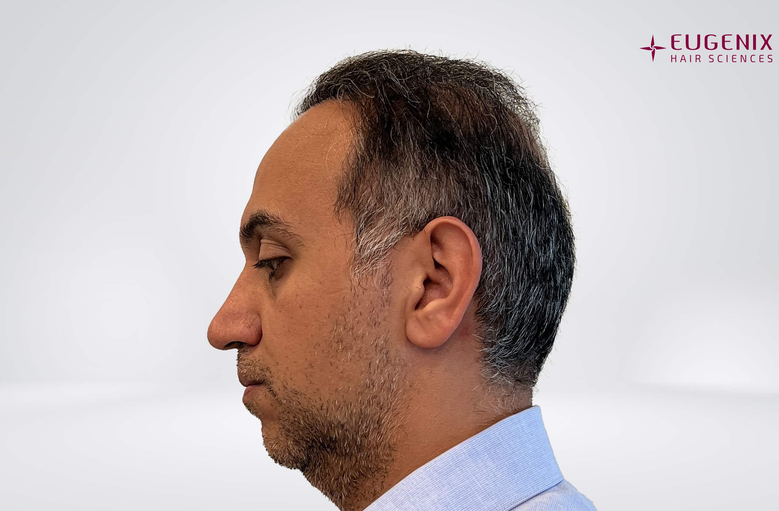 Mr-AS-Right-After