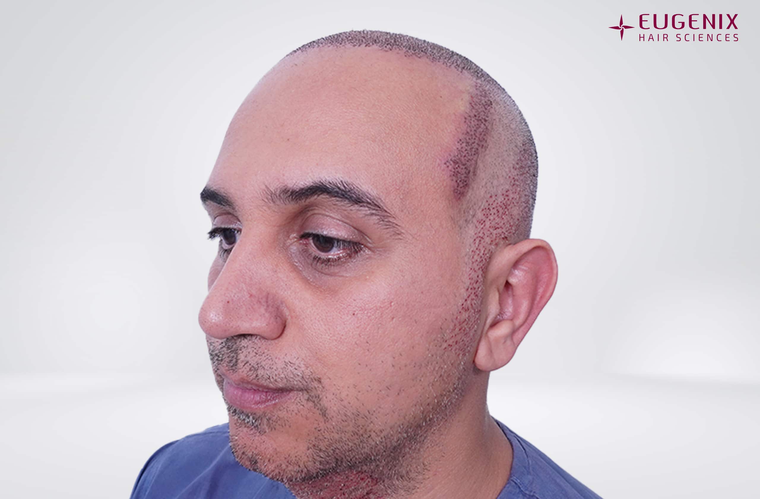 Mr-AS-Right-Post-op
