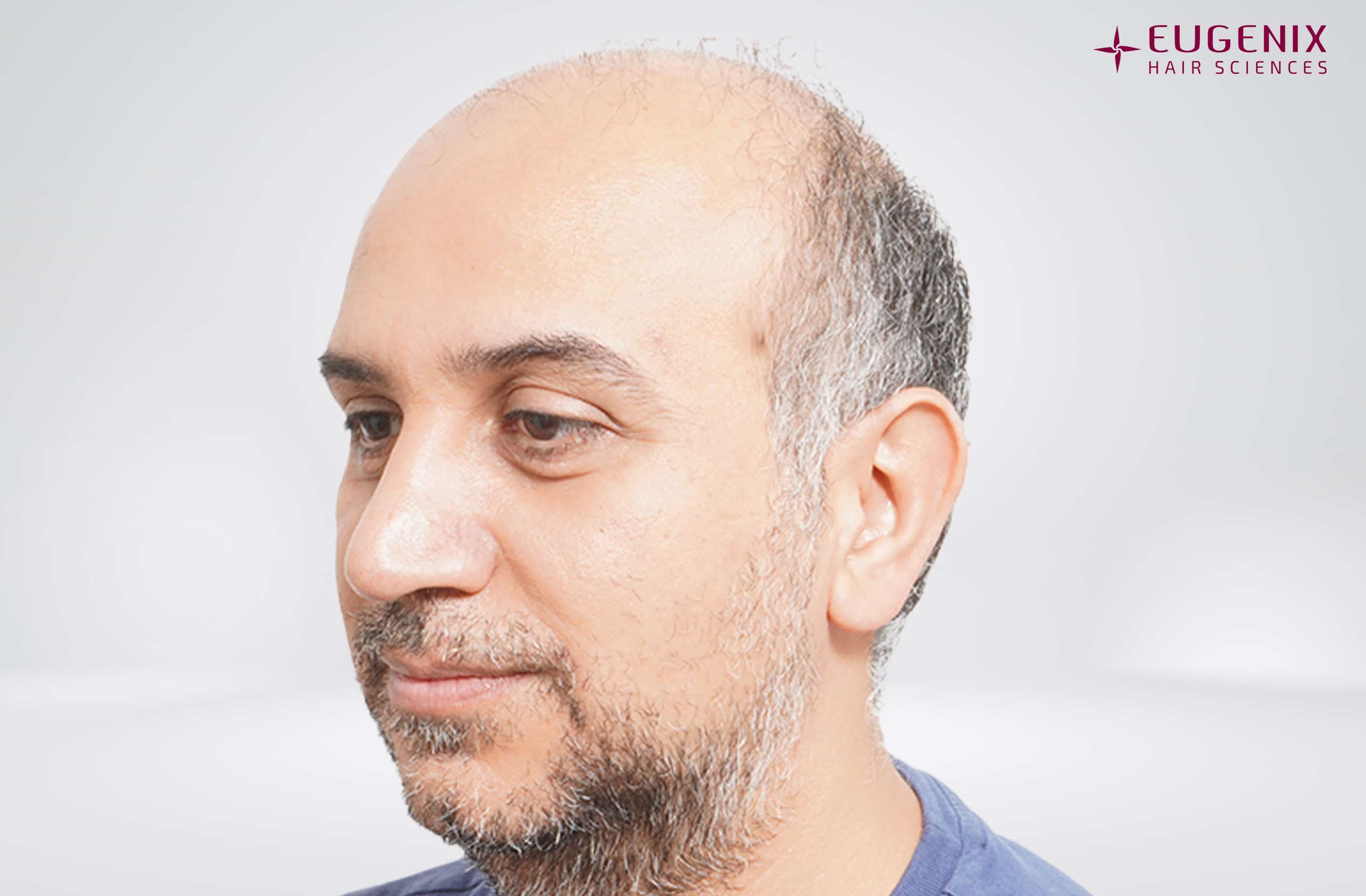 Mr-AS-Right-Pre-op