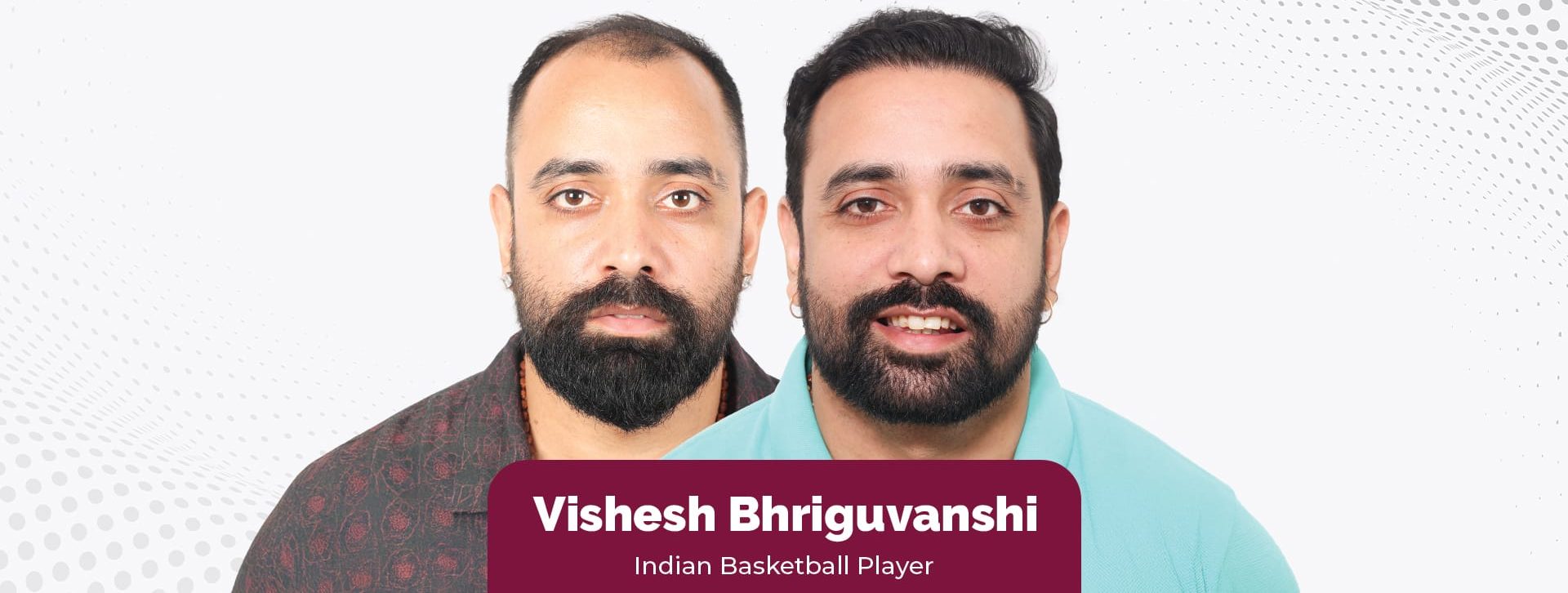 From Court to Confidence: Basketball Player Vishesh Bhriguvanshi’s Hair Transplant Journey at Eugenix Hair Sciences