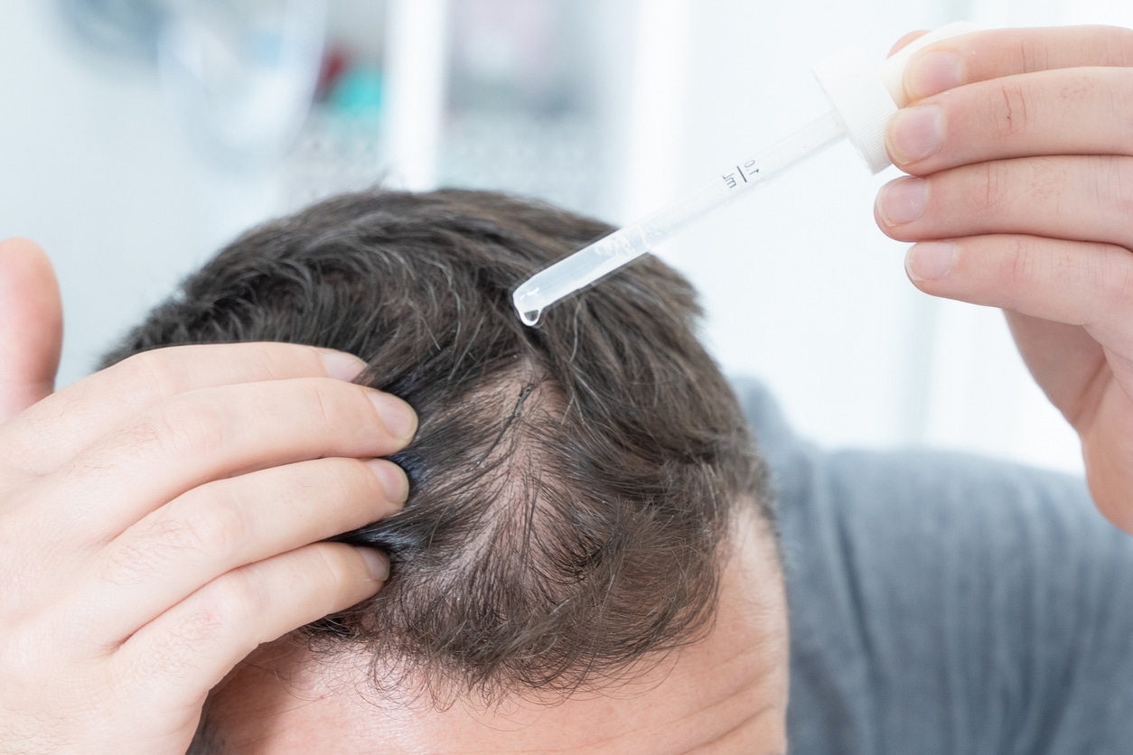 Man doing hair loss treatment as morning routine