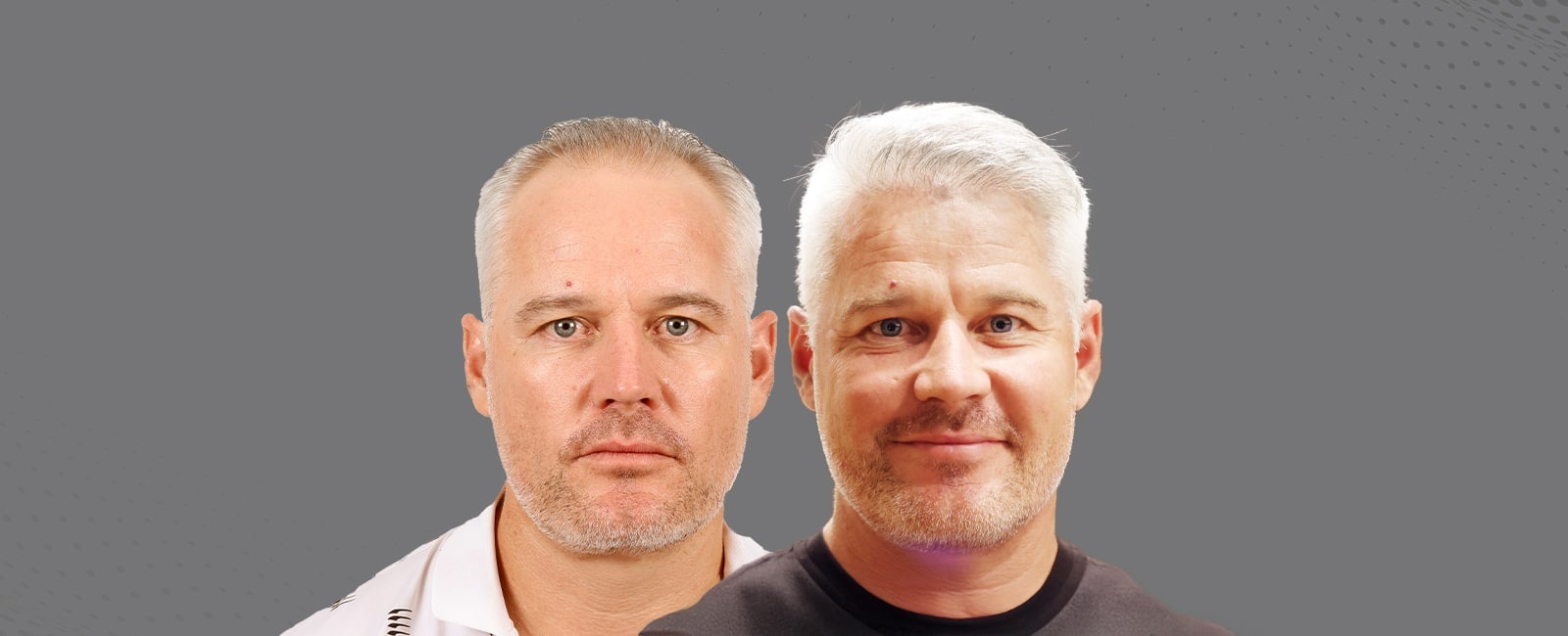 Back to Work in 48 Hours? Here’s the Truth About Fast Recovery Hair Transplants