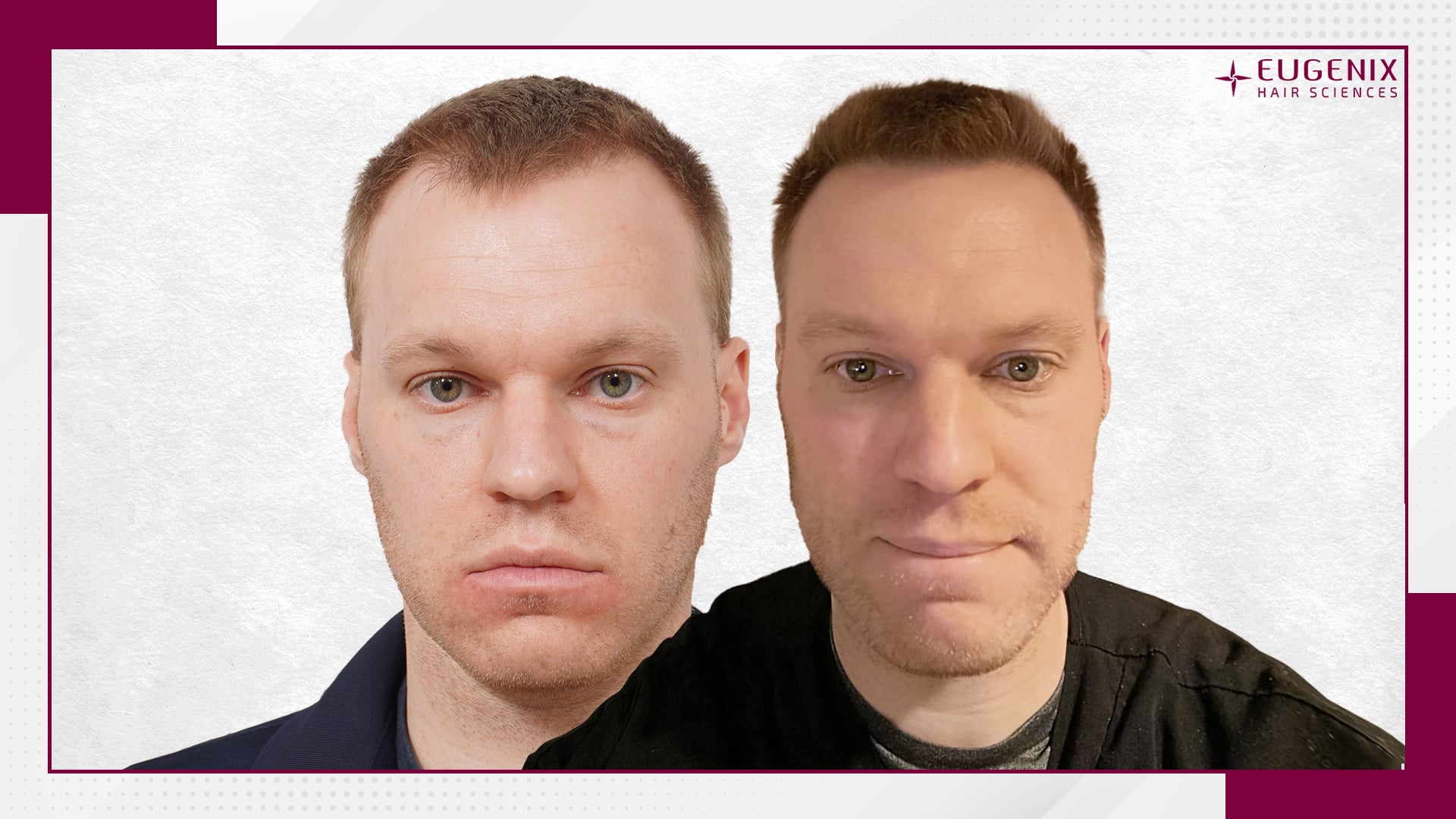 Christopher Wiese Front Before and After copy