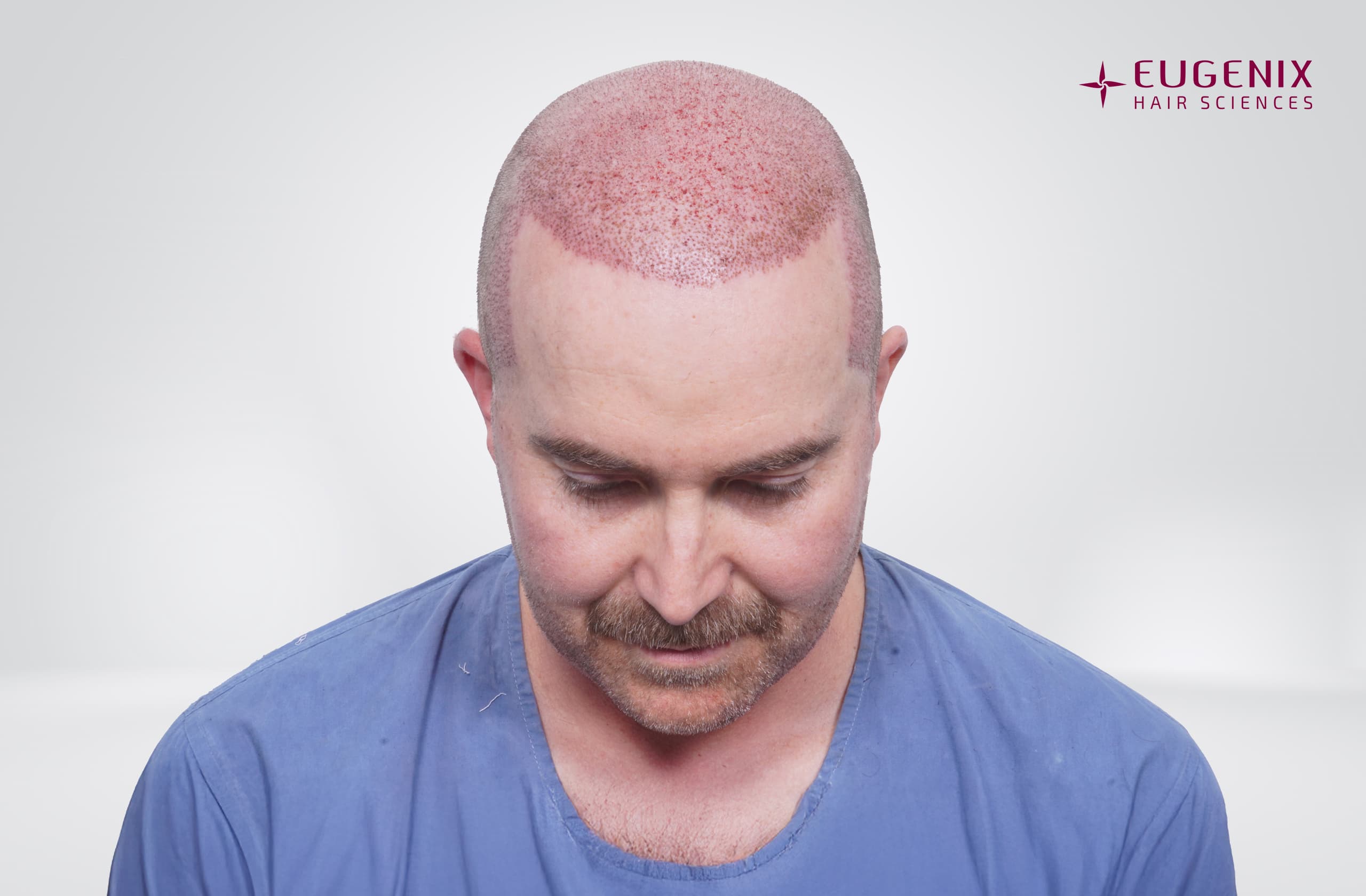 headown post op