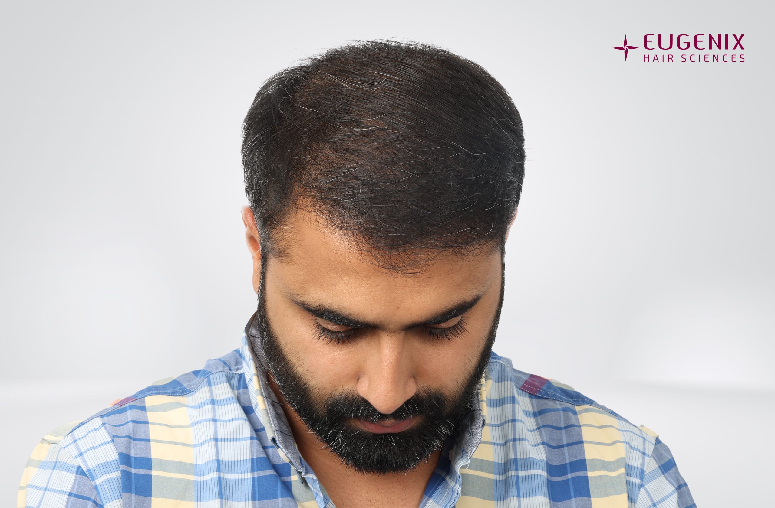 Tushar Naidu After Head Down copy