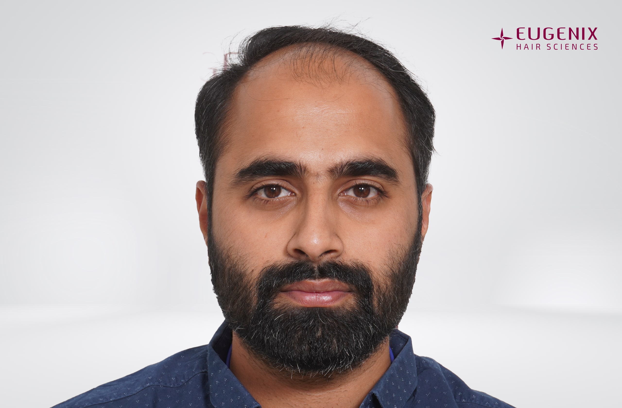 Tushar Naidu Before Front copy
