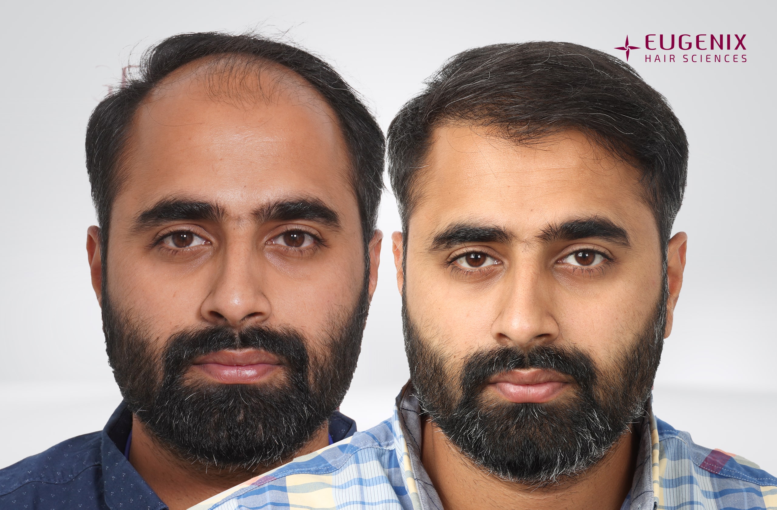 Tushar Naidu Before & Front copy