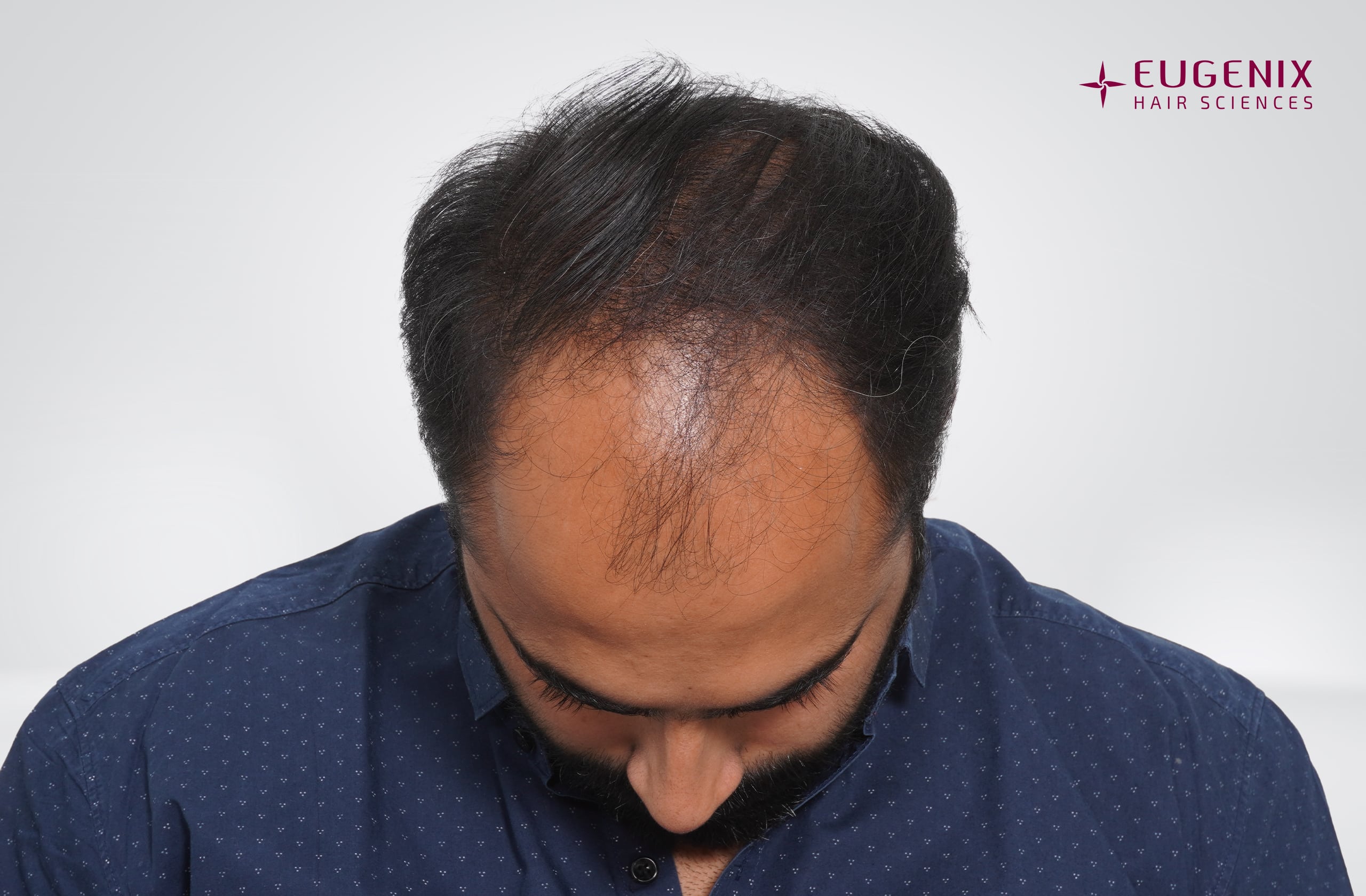 Tushar Naidu Before Head Down copy