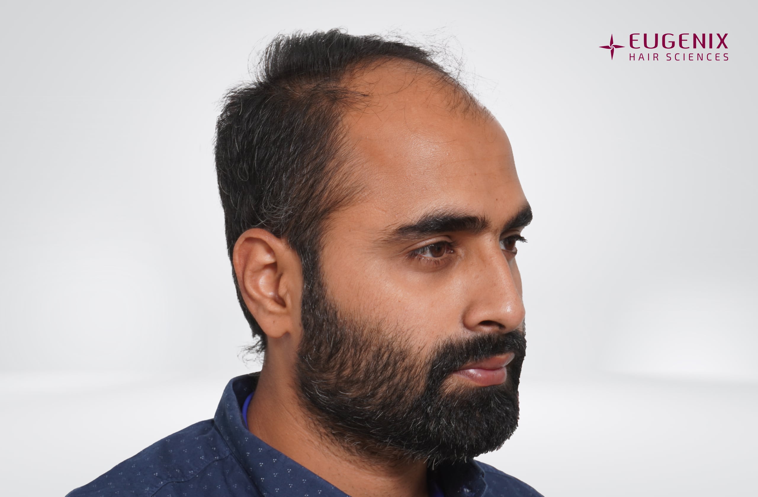 Tushar Naidu Before Left copy