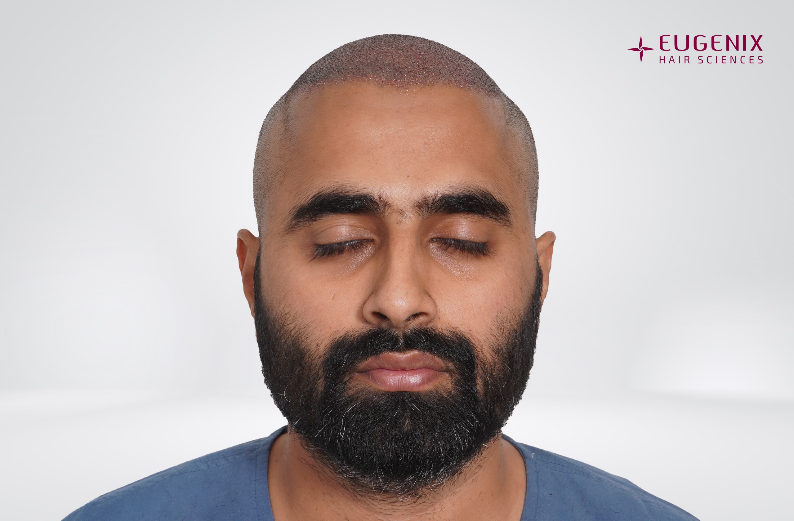 Tushar Naidu Post-op Front copy