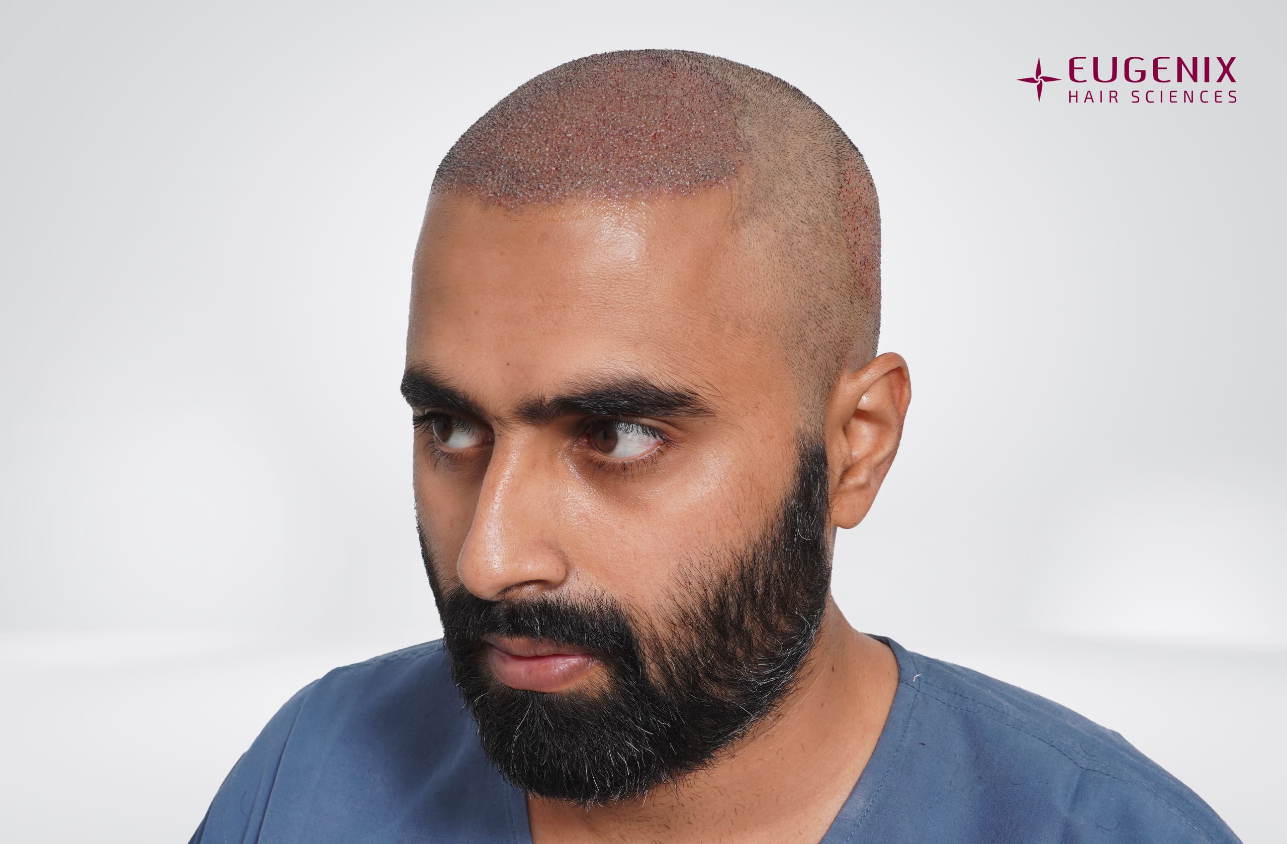 Tushar Naidu Post-op Right copy