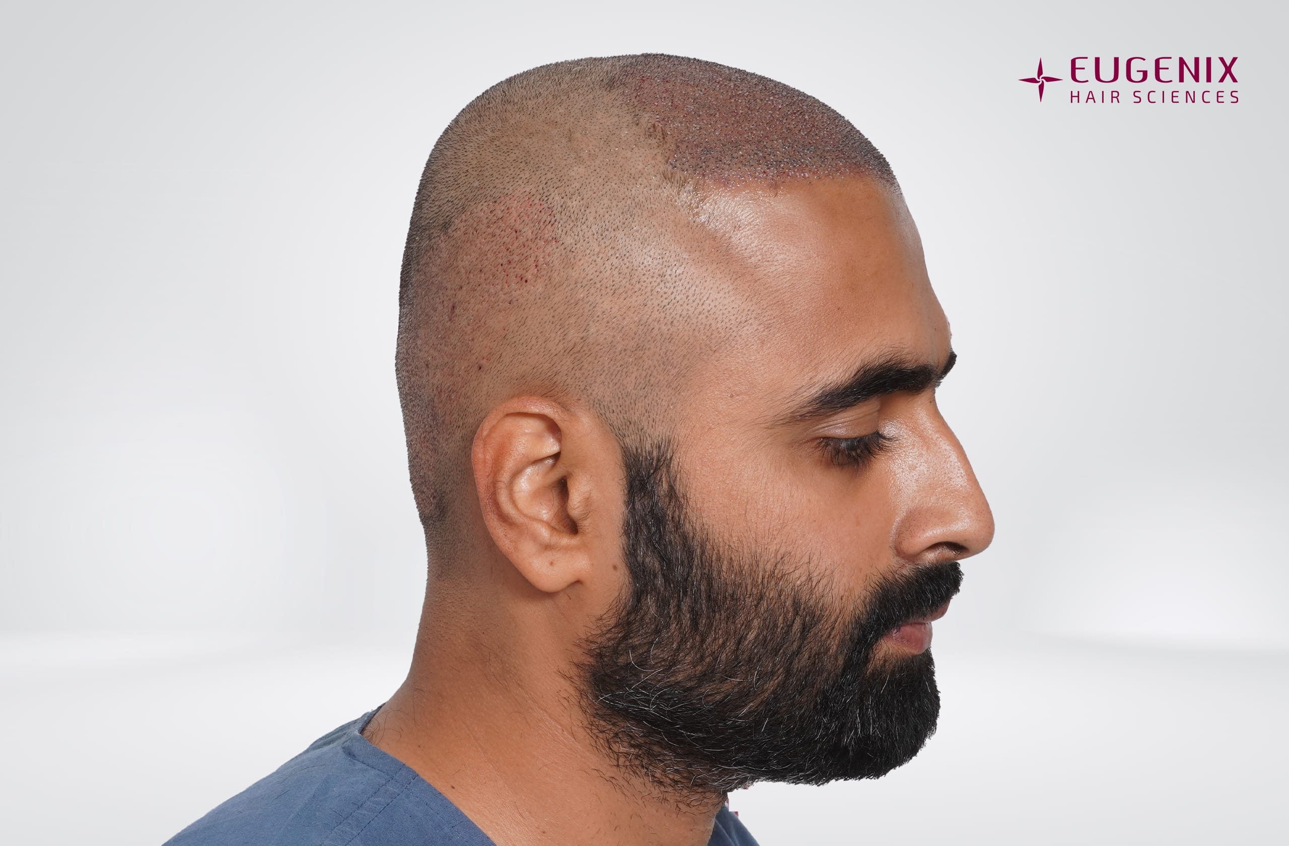 Tushar Naidu Post-op left copy