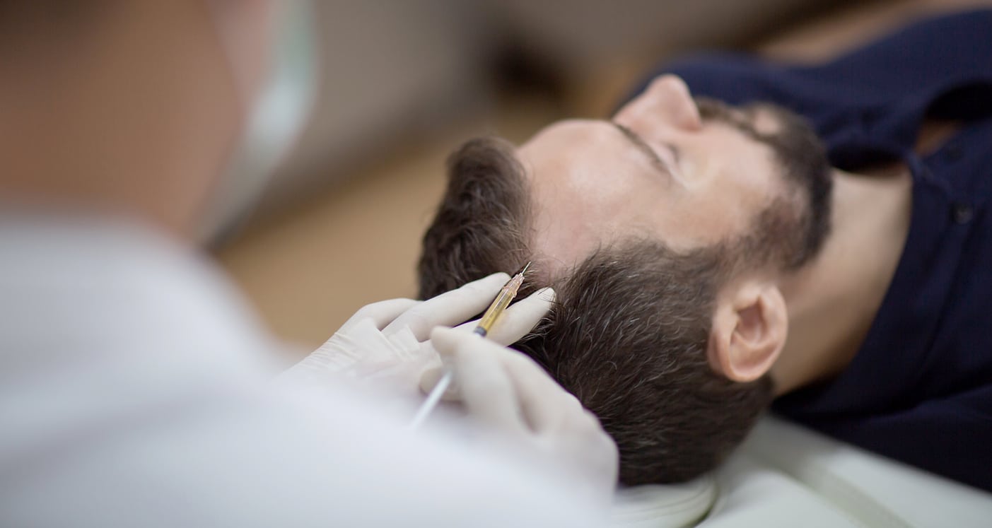 Hair mesotherapy or scalp prp: Platelet-rich plasma procedure. Beautician doctor makes injections in the man head for hair growth to prevent hair loss and baldness