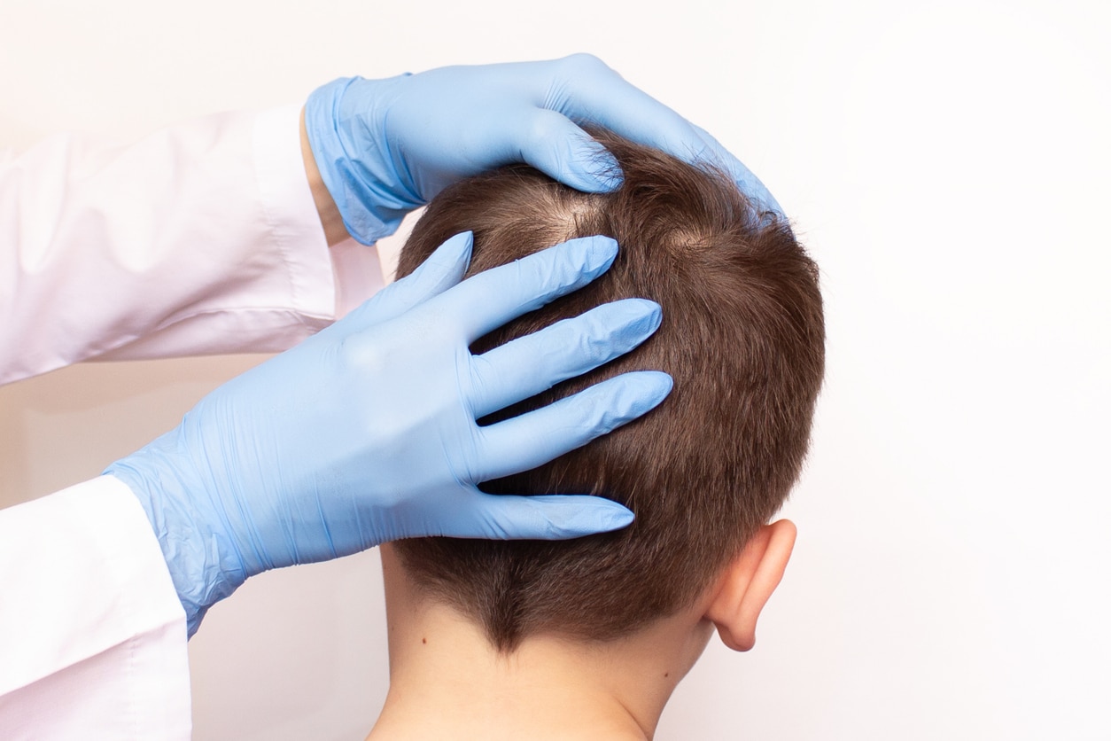 The Role of Surgeon Experience in Hair Transplant Safety